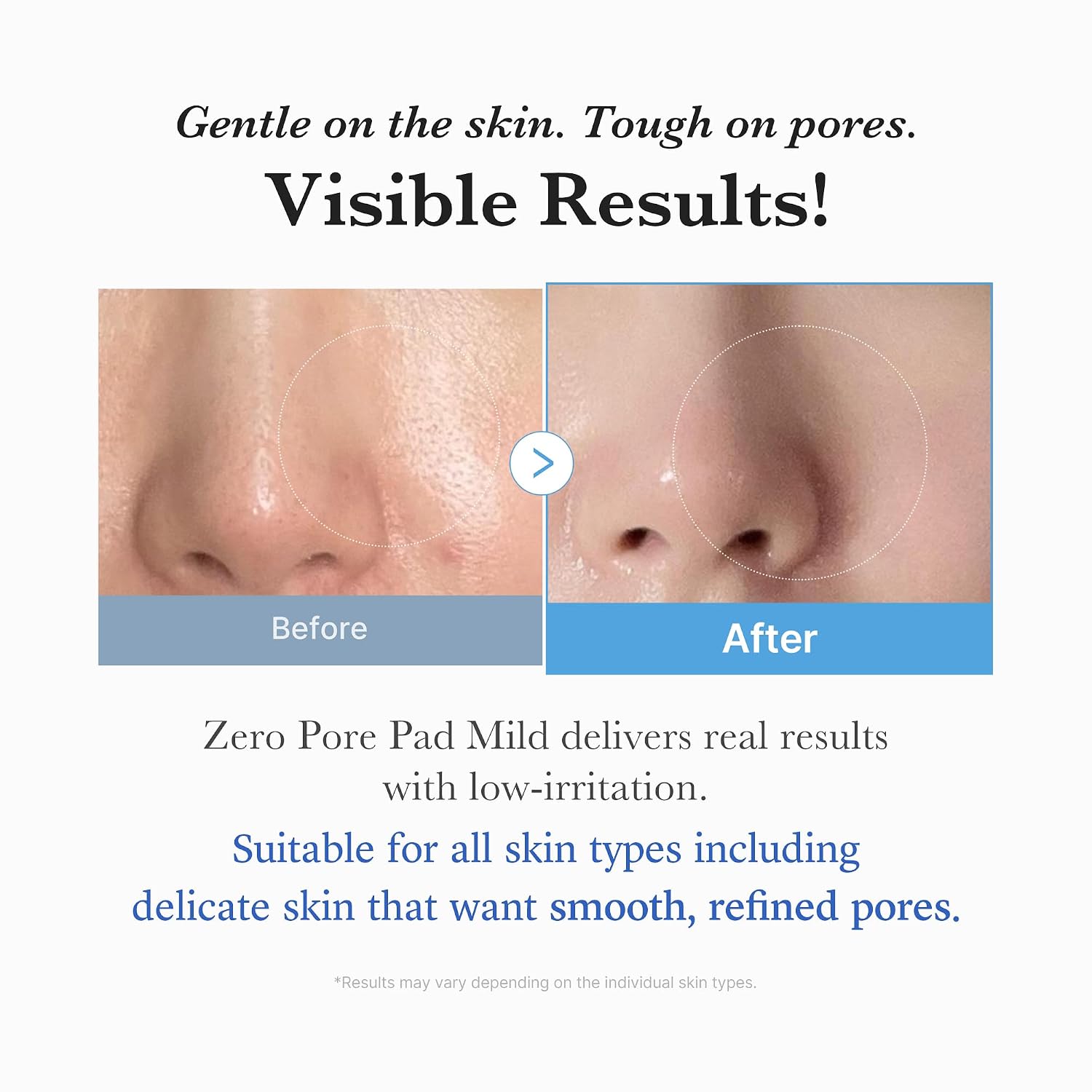 TÓNICO EN DISCOS MEDICUBE ZERO PORE PAD MILD 2.0 EXFOLIANTE SUAVE - 5