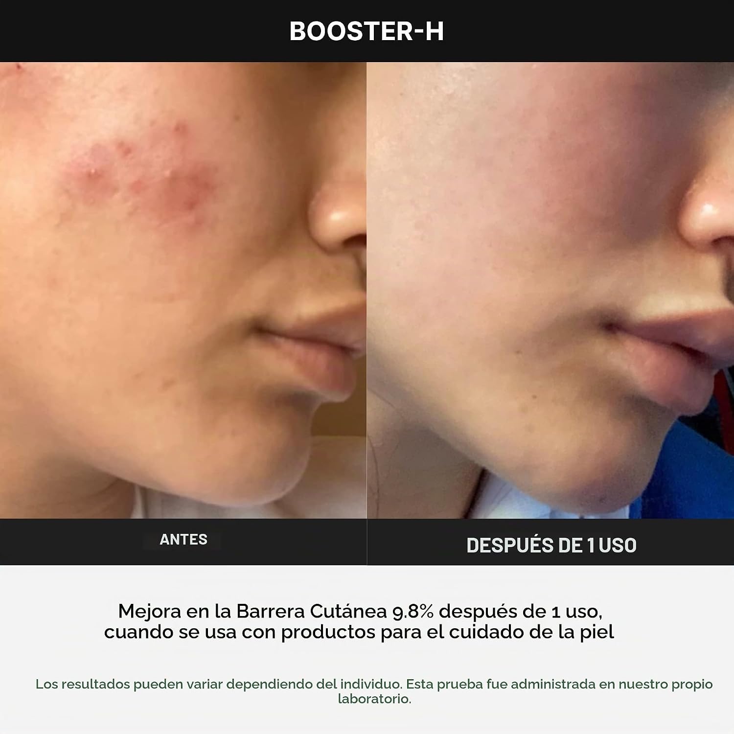 DISPOSITIVO MEDICUBE AGE-R BOOSTER-H PARA ABSORCIÓN DE SKINCARE - 4