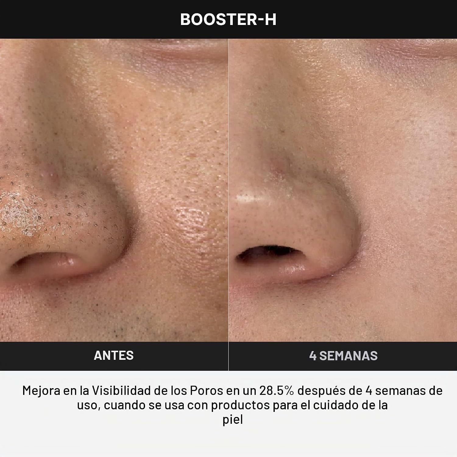 DISPOSITIVO MEDICUBE AGE-R BOOSTER-H PARA ABSORCIÓN DE SKINCARE - 5