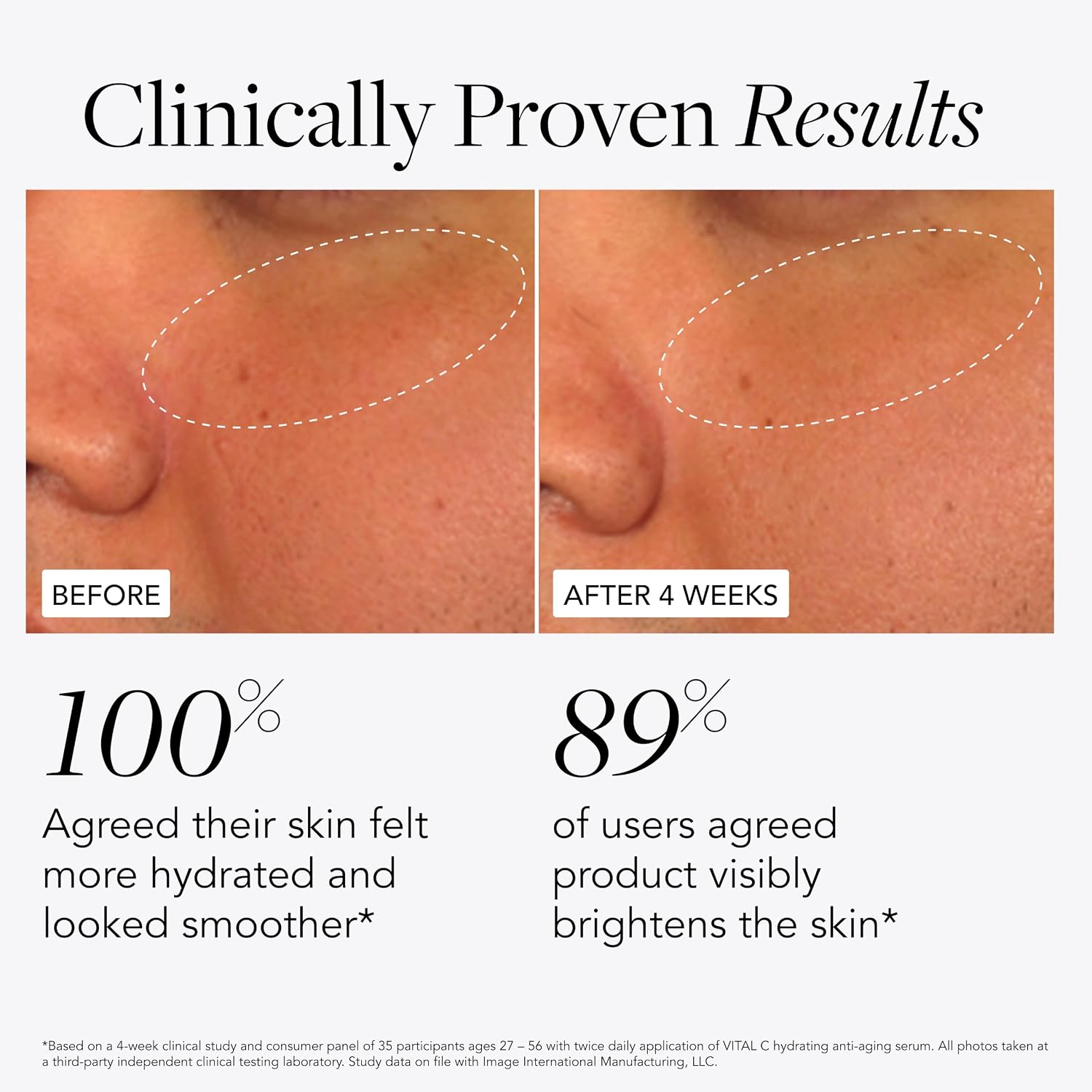SERUM FACIAL HIDRATANTE IMAGE SKINCARE VITAL C CON VITAMINA C Y ÁCIDO HIALURÓNICO - 5