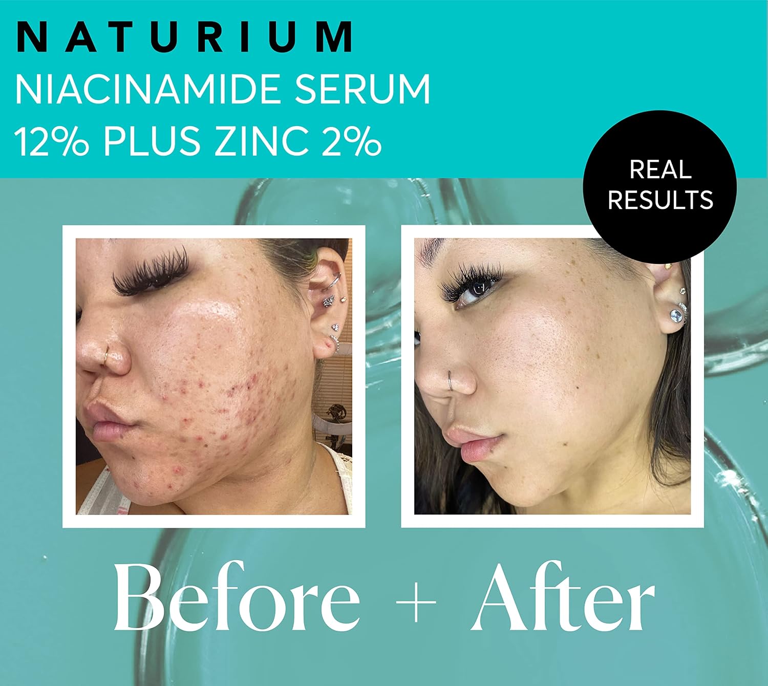 SERUM NATURIUM NIACINAMIDA 12% PLUS ZINC 2%, 30 ML - 5