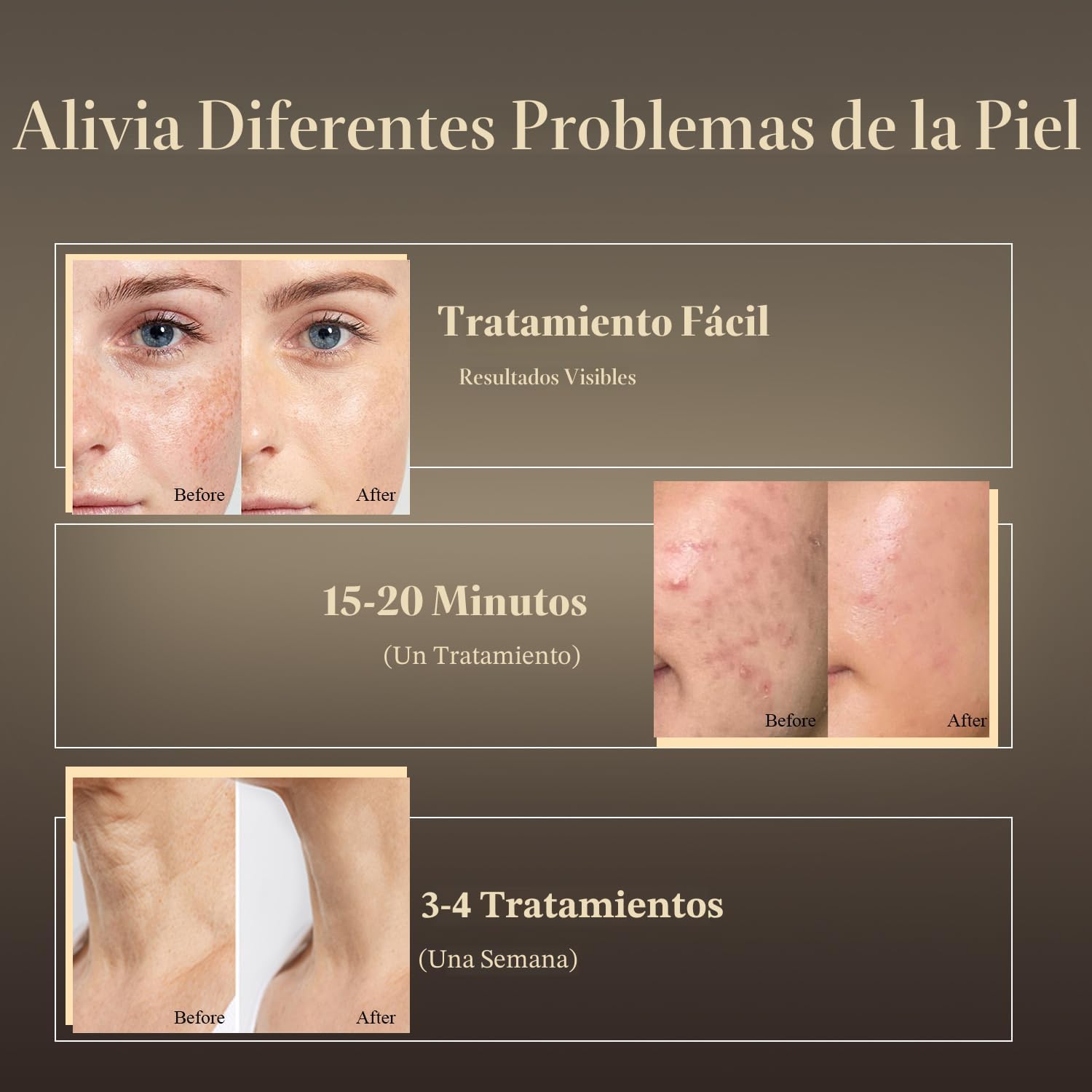 MASCARILLA FACIAL LED MEGELIN 7 COLORES CON TERAPIA DE LUZ ROJA PARA ROSTRO Y CUELLO - 5
