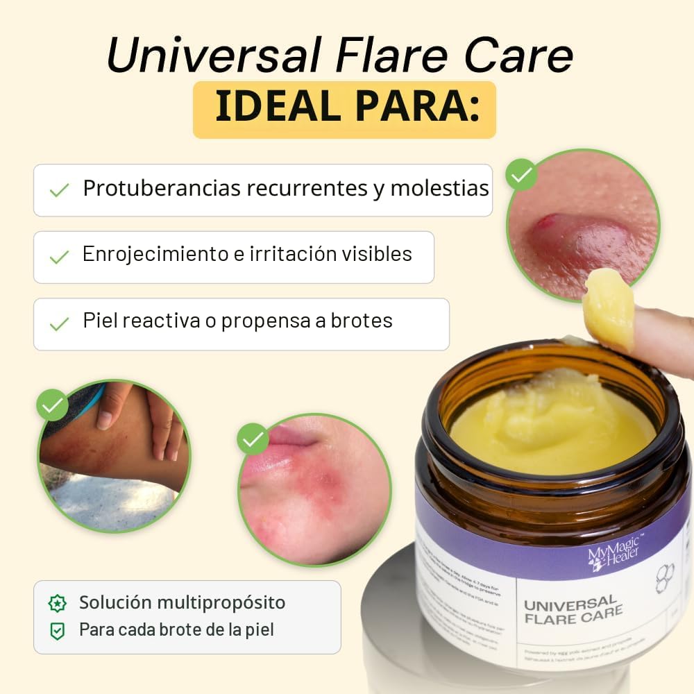 POMADA MYMAGICHEALER UNIVERSAL FLARE CARE PARA IRRITACIONES DE PIEL 2 OZ - 2