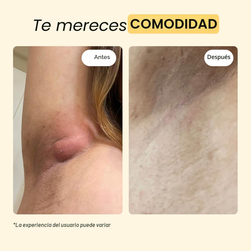 POMADA MYMAGICHEALER UNIVERSAL FLARE CARE PARA IRRITACIONES DE PIEL 2 OZ - 4