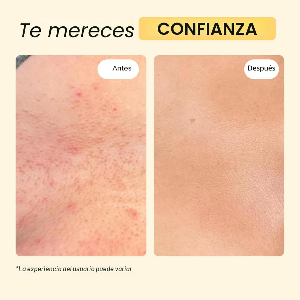 POMADA MYMAGICHEALER UNIVERSAL FLARE CARE PARA IRRITACIONES DE PIEL 2 OZ - 5