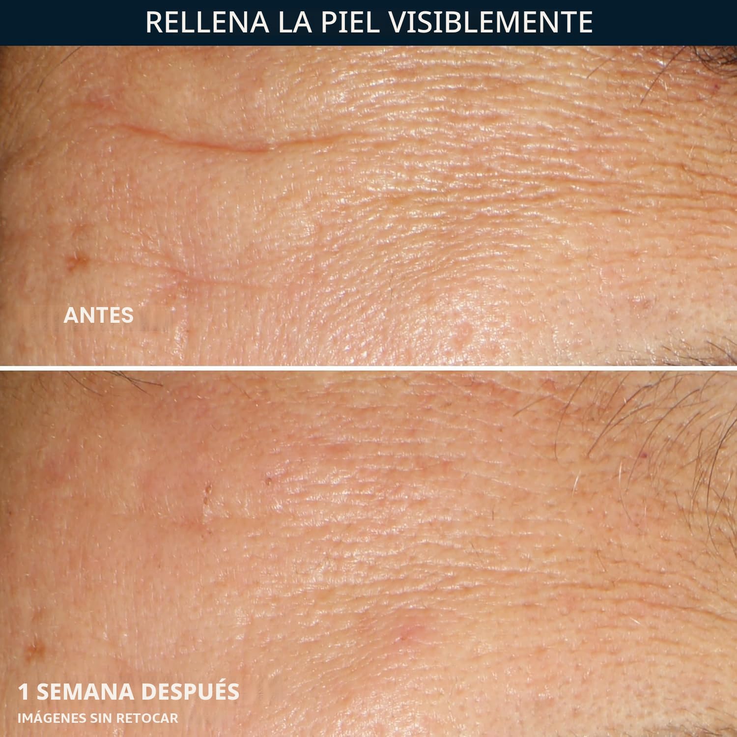 CÁPSULAS DE SÉRUM NOCTURNO ROC ÁCIDO HIALURÓNICO 30 UNIDADES + CÁPSULAS RETINOL 7 UNIDADES - 3