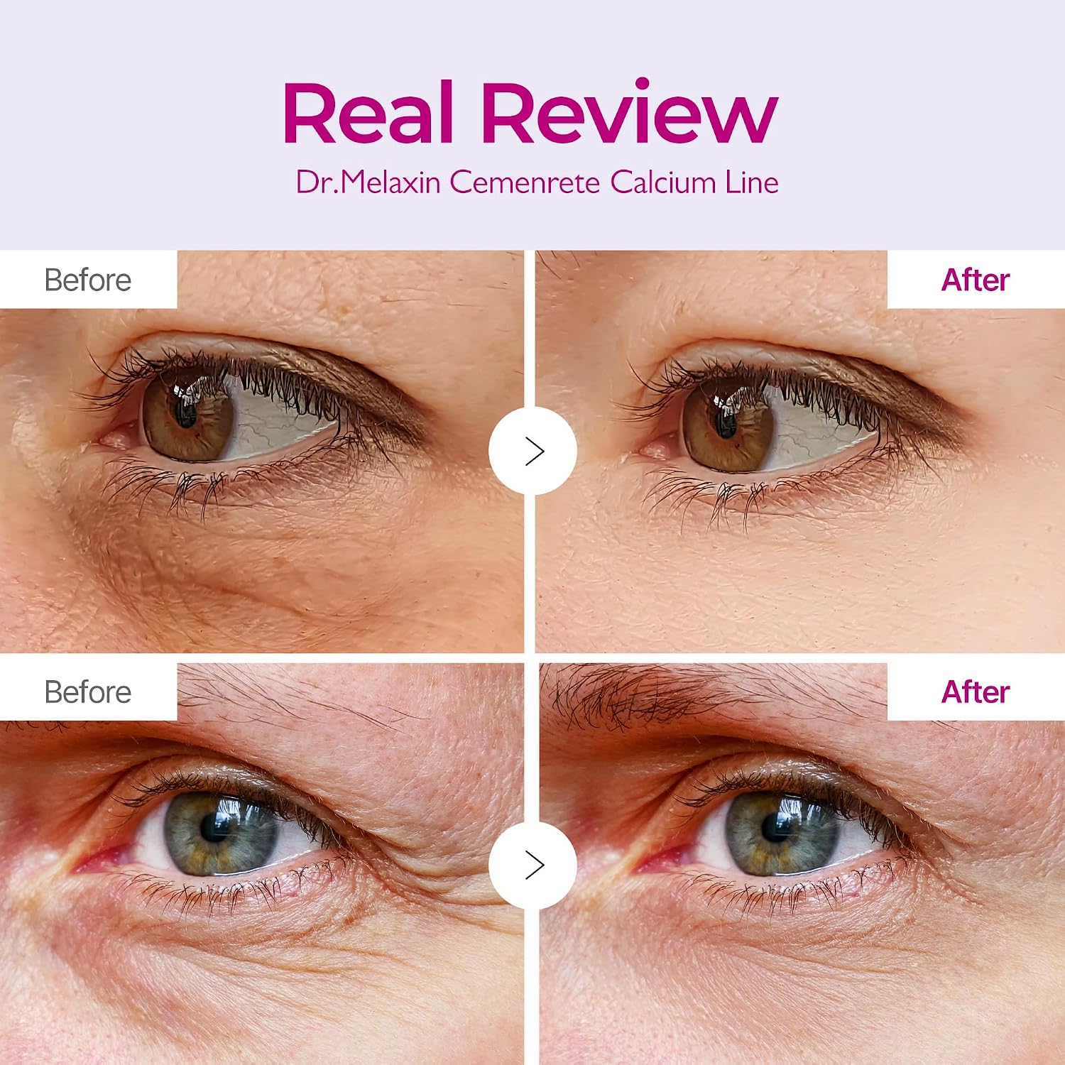 MASCARILLA FACIAL DR.MELAXIN CALCIUM VOLUME UNDER EYE PATCHES 60 UNIDADES - 3