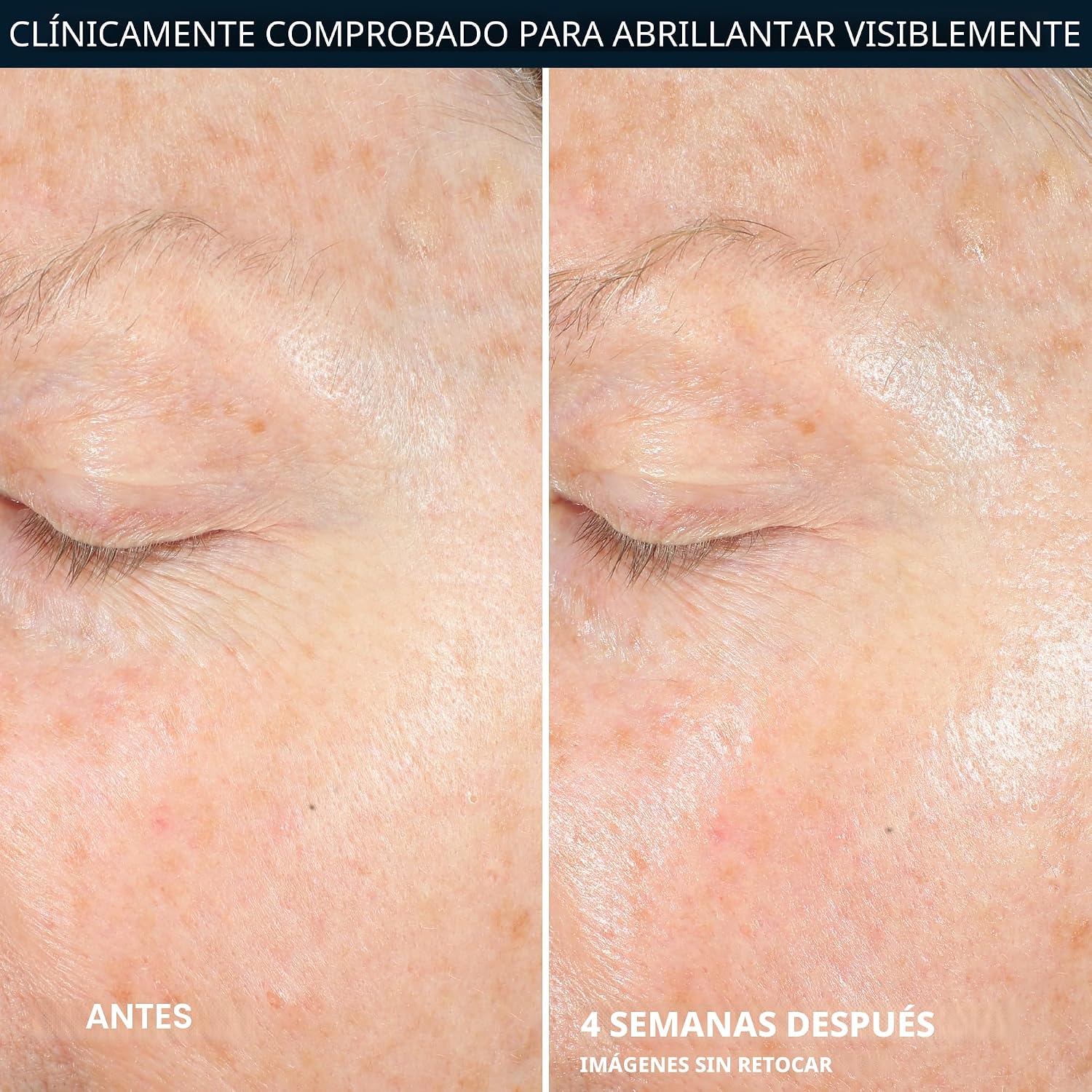 HIDRATANTE FACIAL ROC MULTI CORREXION REVIVE + GLOW CON VITAMINA C 10%, 50ML - 5