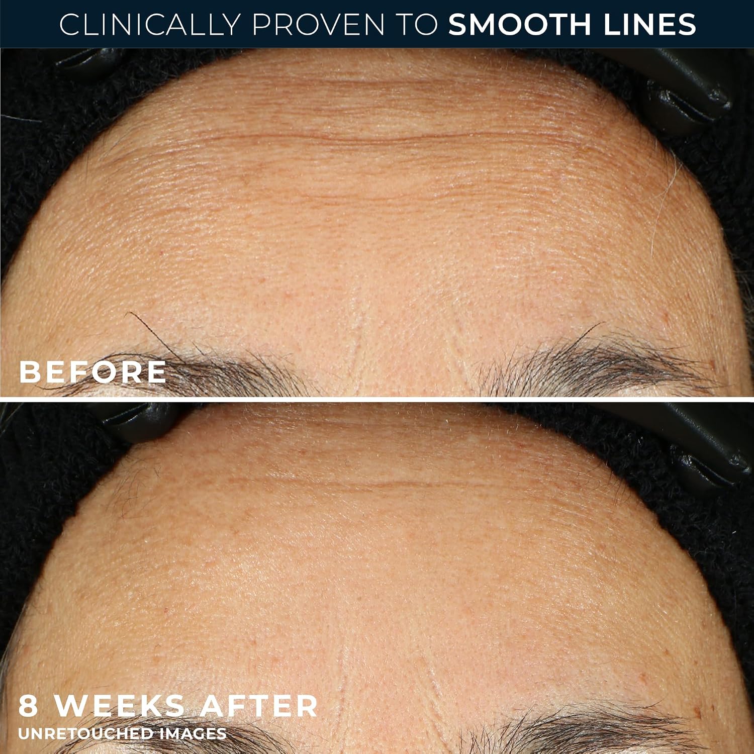 SÉRUM NOCTURNO ROC RETINOL CORREXION ANTI-ENVEJECIMIENTO EN CÁPSULAS, 80 UNIDADES - 4