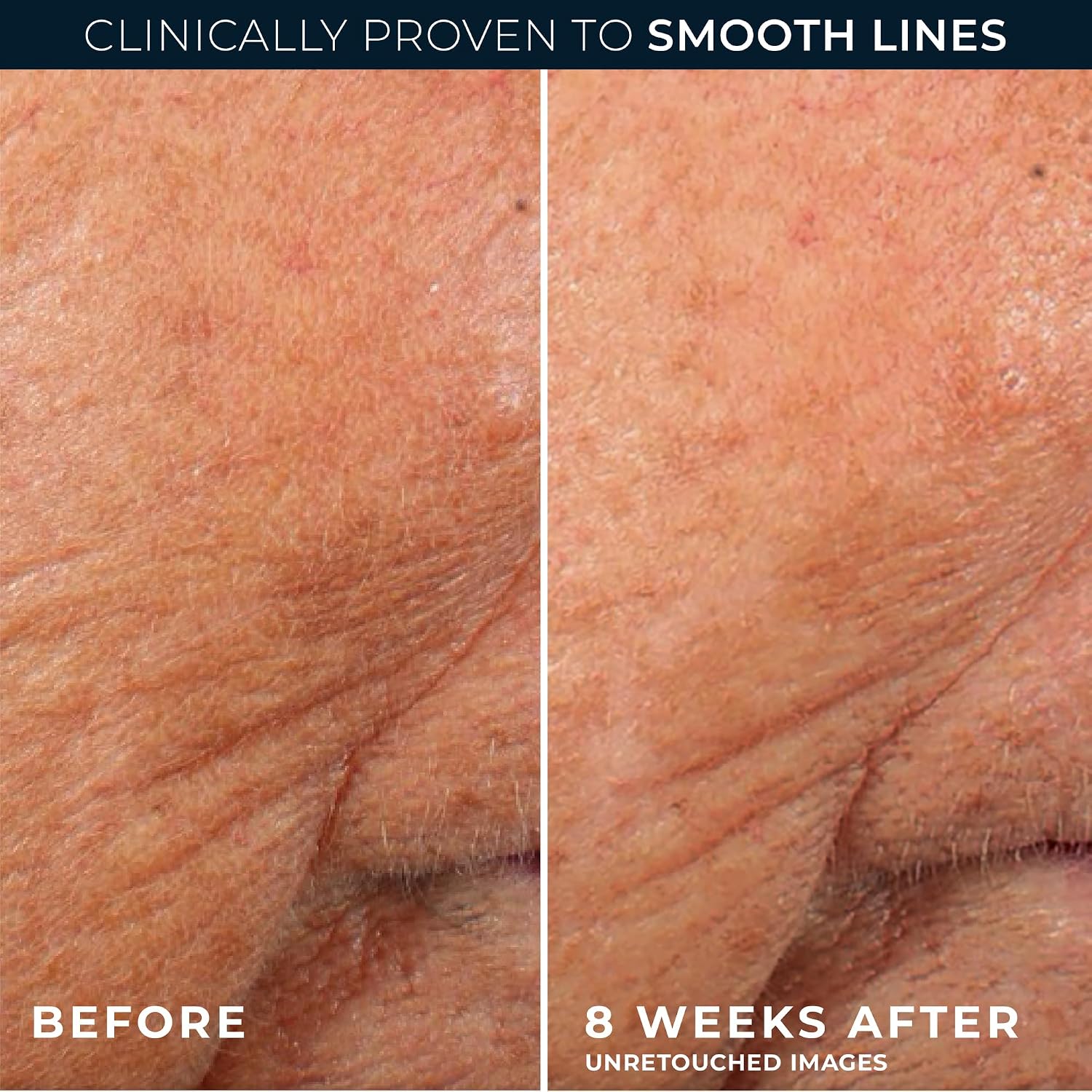 SÉRUM NOCTURNO ROC RETINOL CORREXION ANTI-ENVEJECIMIENTO EN CÁPSULAS, 80 UNIDADES - 5