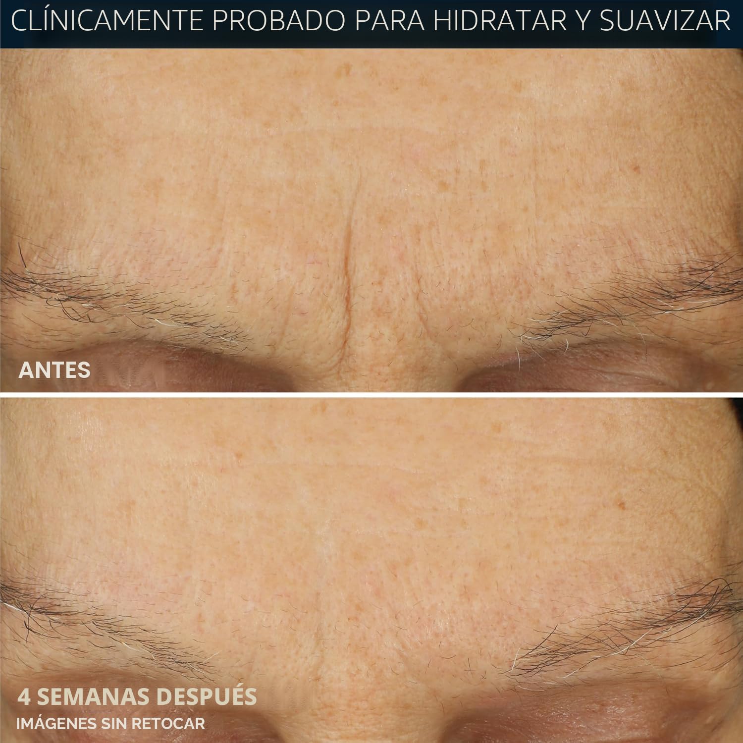 CREMA HIDRATANTE FACIAL ROC RETINOL CORREXION MAX DAILY SIN FRAGANCIA 1.7 OZ - 4