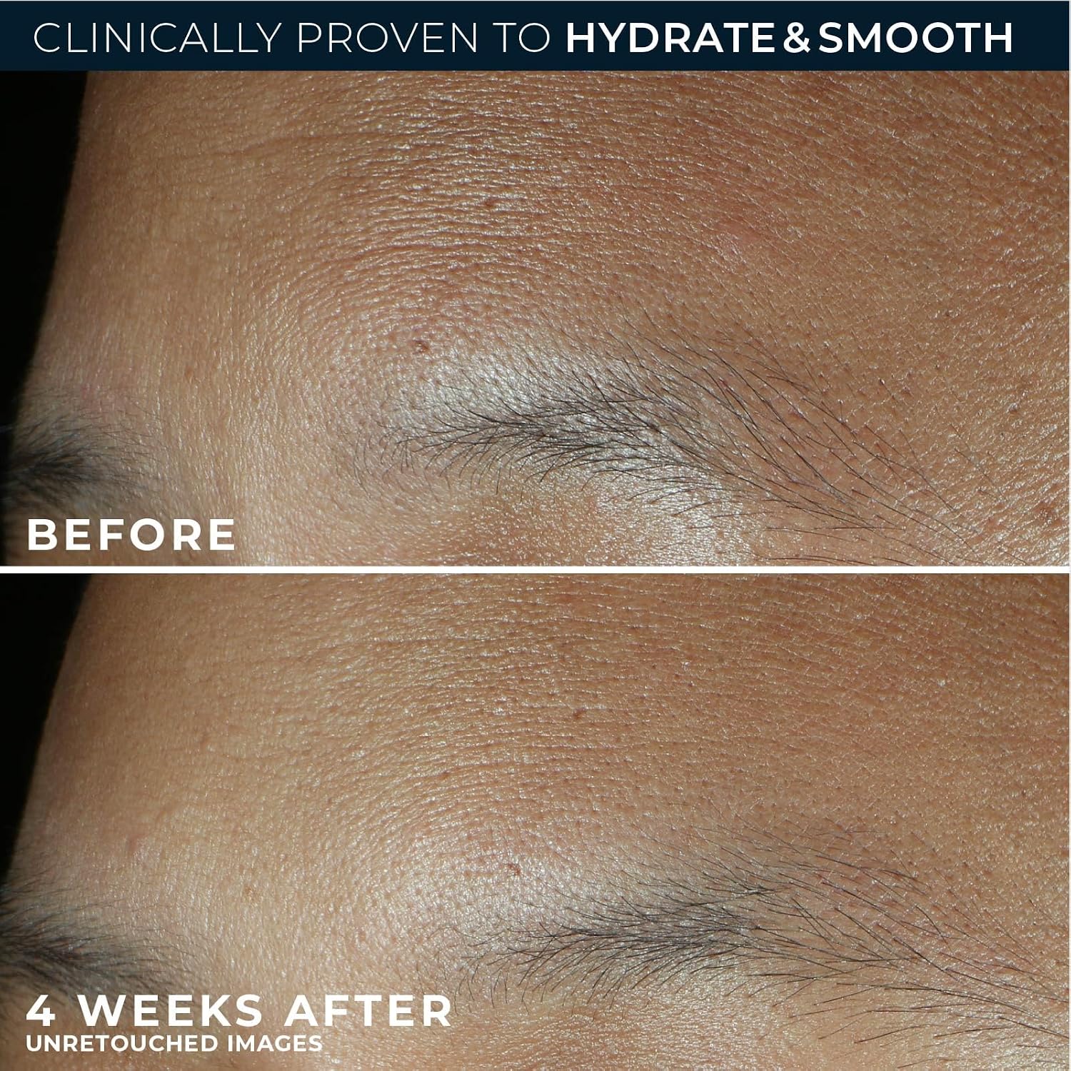 CREMA HIDRATANTE FACIAL ROC RETINOL CORREXION MAX DAILY SIN FRAGANCIA 1.7 OZ - 5