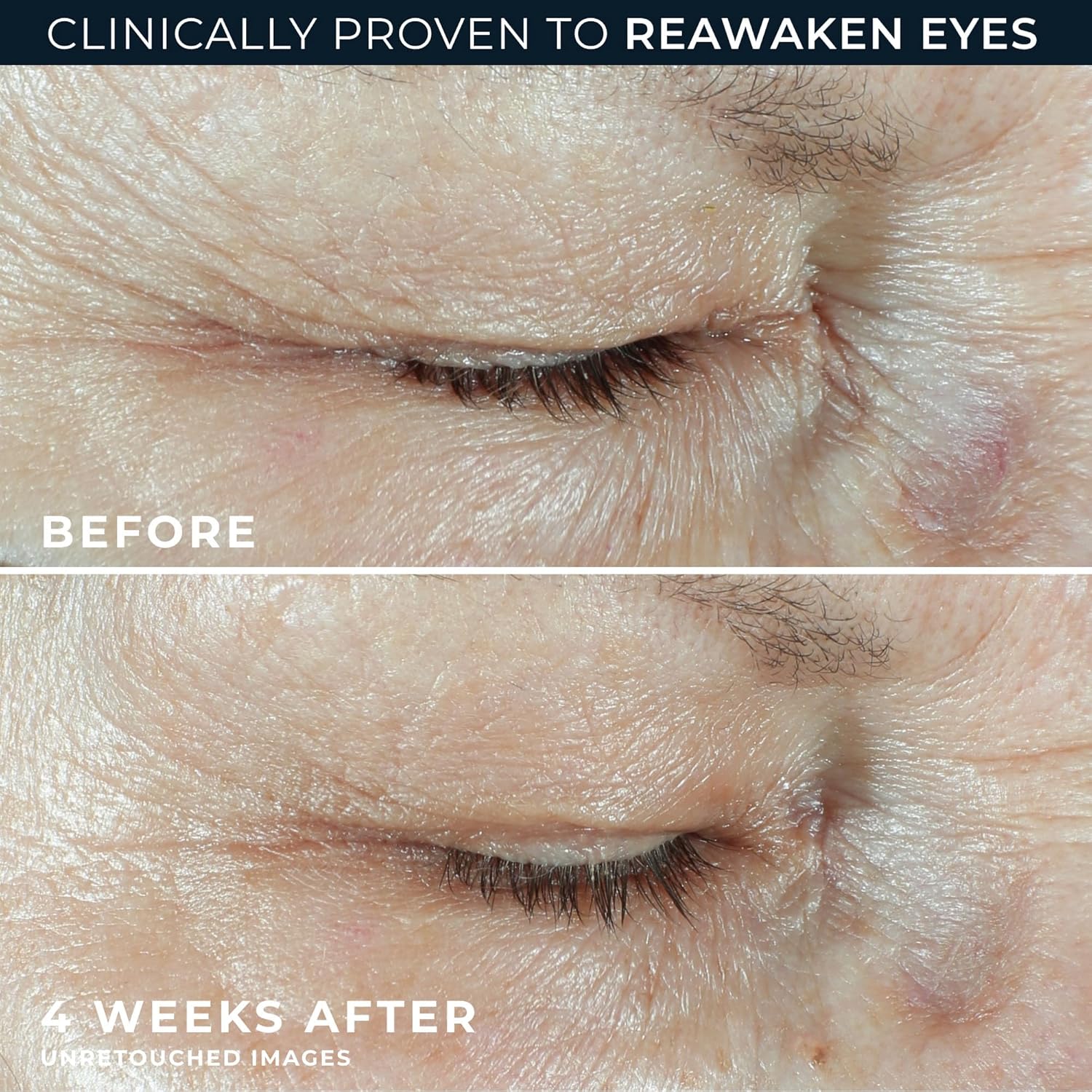CREMA CONTORNO DE OJOS ROC ÁCIDO HIALURÓNICO ANTIEDAD 15ML + CÁPSULAS DE RETINOL 7 UNIDADES - 5