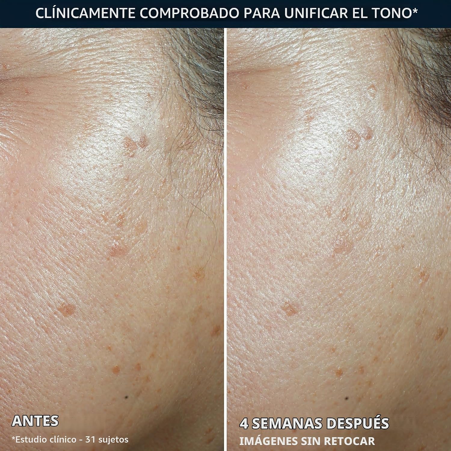 HIDRATANTE FACIAL ROC NIACINAMIDA SPF 30 TONO UNIFORME + LIFT - 5