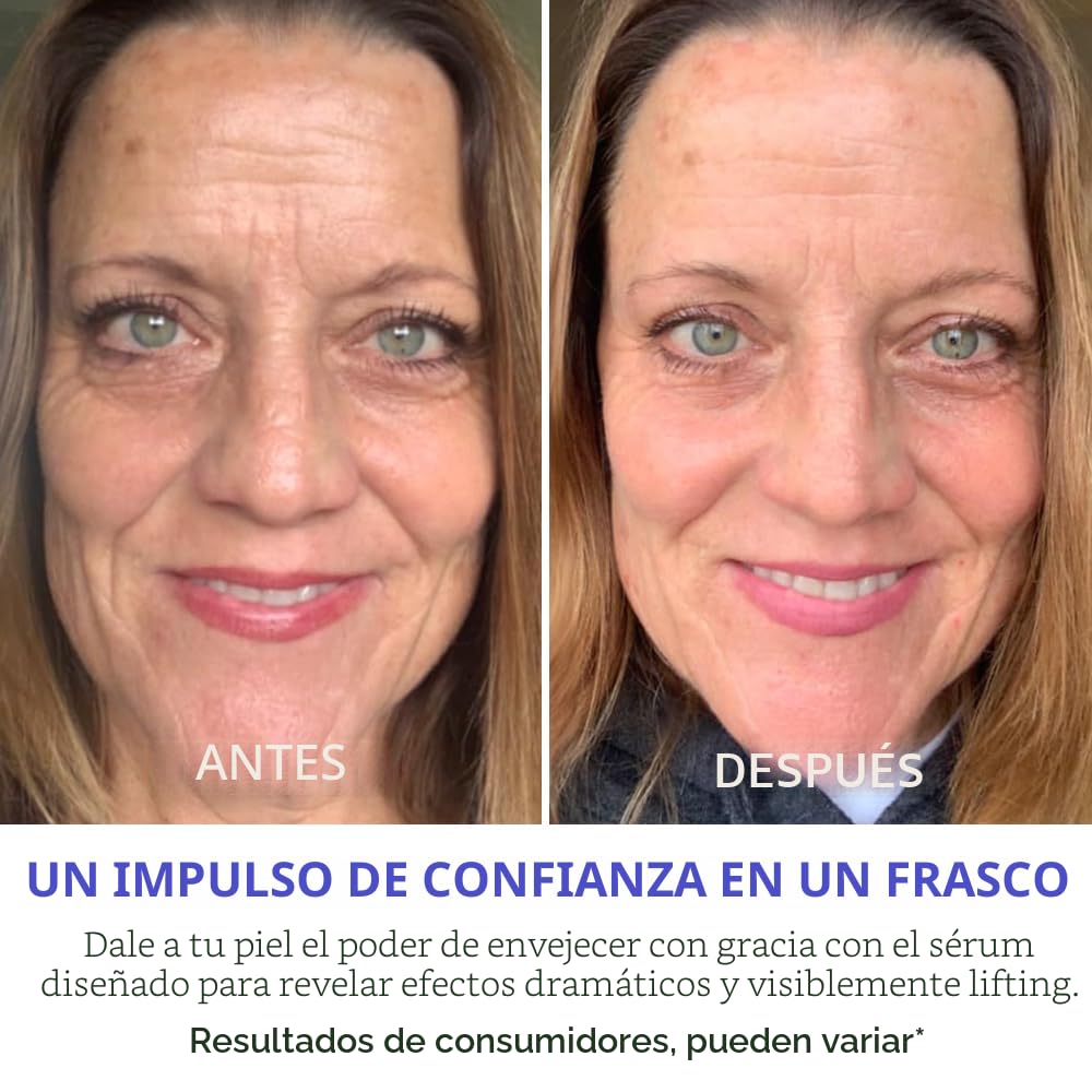 SÉRUM FACIAL GOPURE ACTIVES FIRM Y LIFT ANTIEDAD CON RETINOL 30ML - 4