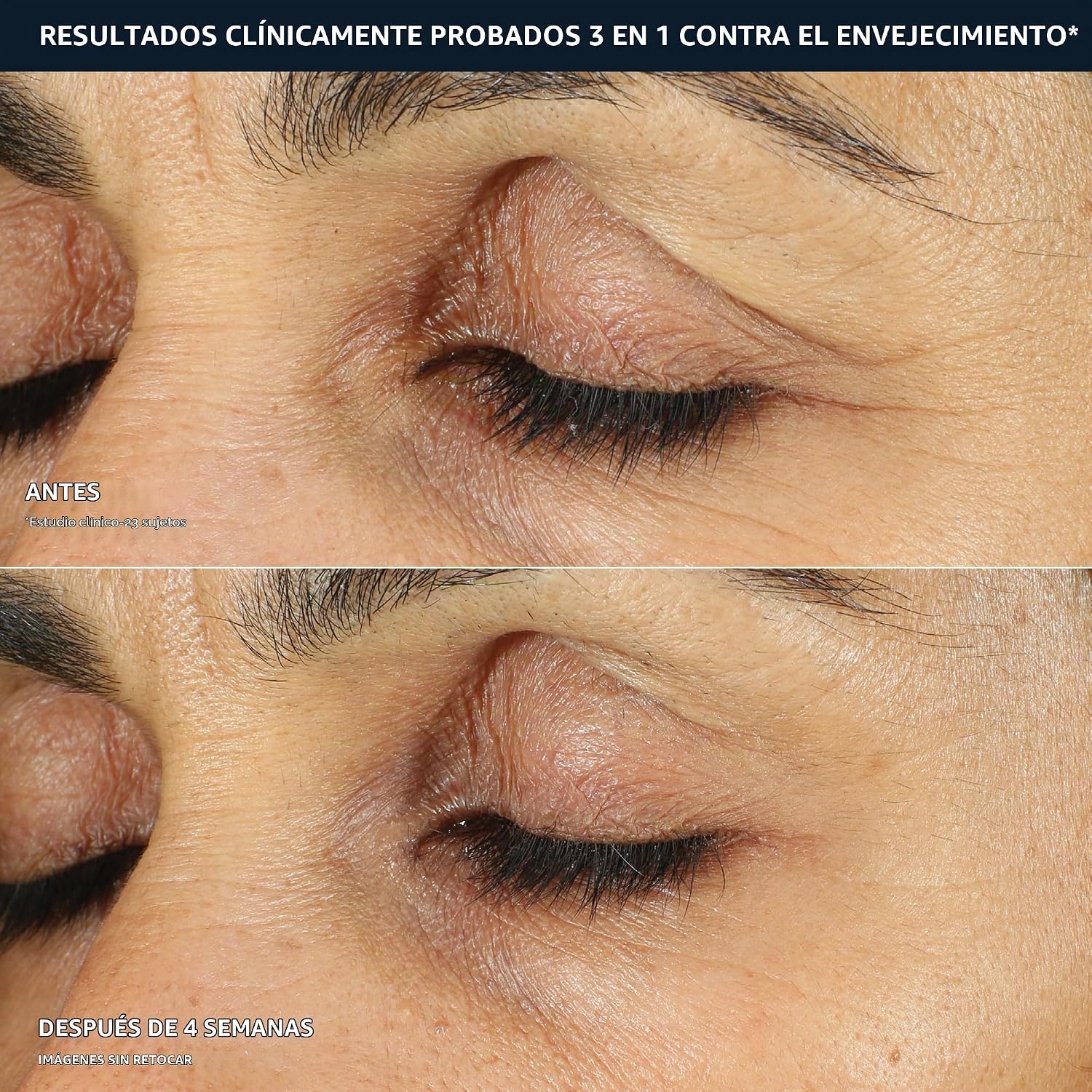 CREMA PARA CONTORNO DE OJOS ROC RETINOL CORREXION 0.5 OZ - 4
