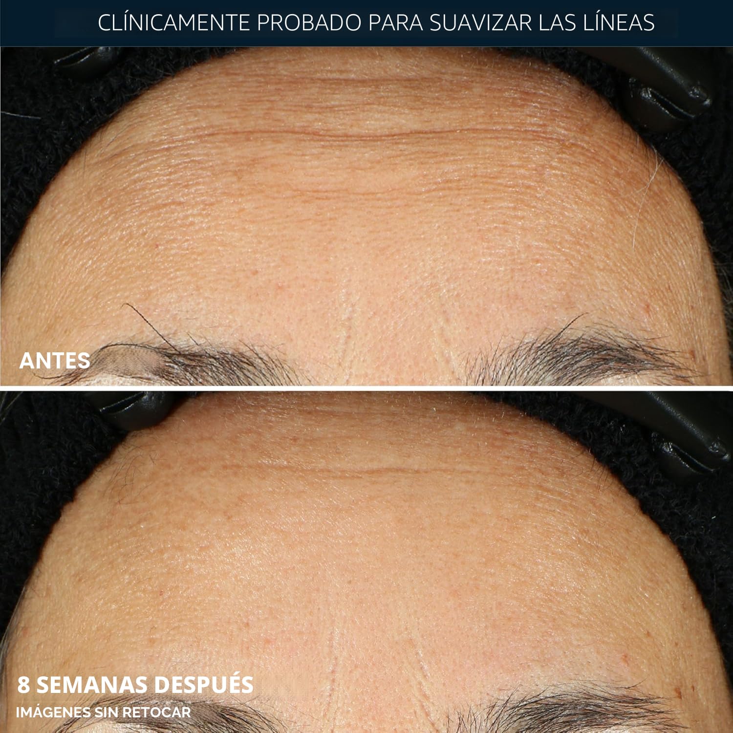 SÉRUM NOCTURNO ROC RETINOL CORREXION ANTIEDAD EN CÁPSULAS, 30 UNIDADES - 4