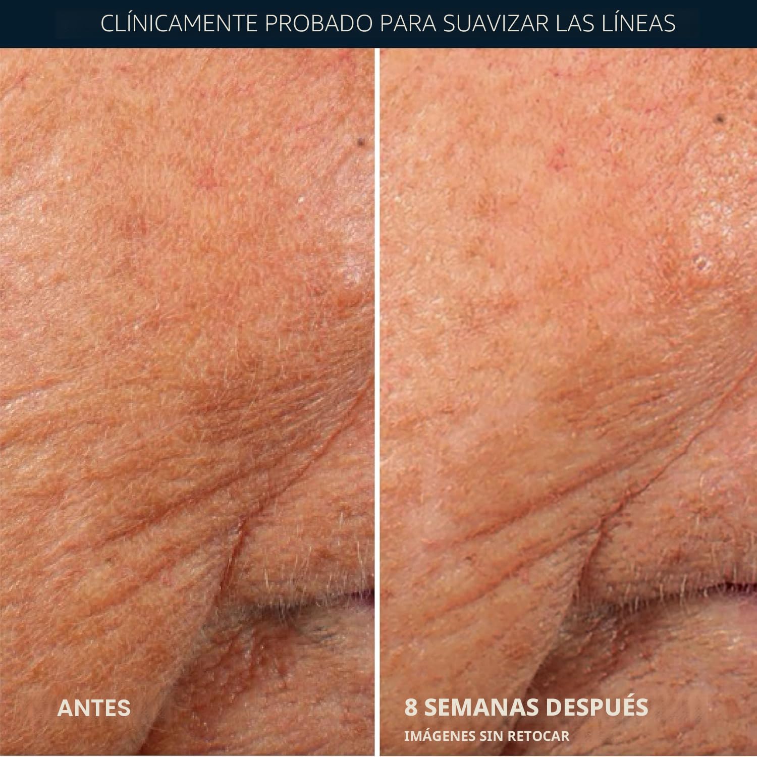 SÉRUM NOCTURNO ROC RETINOL CORREXION ANTIEDAD EN CÁPSULAS, 30 UNIDADES - 5