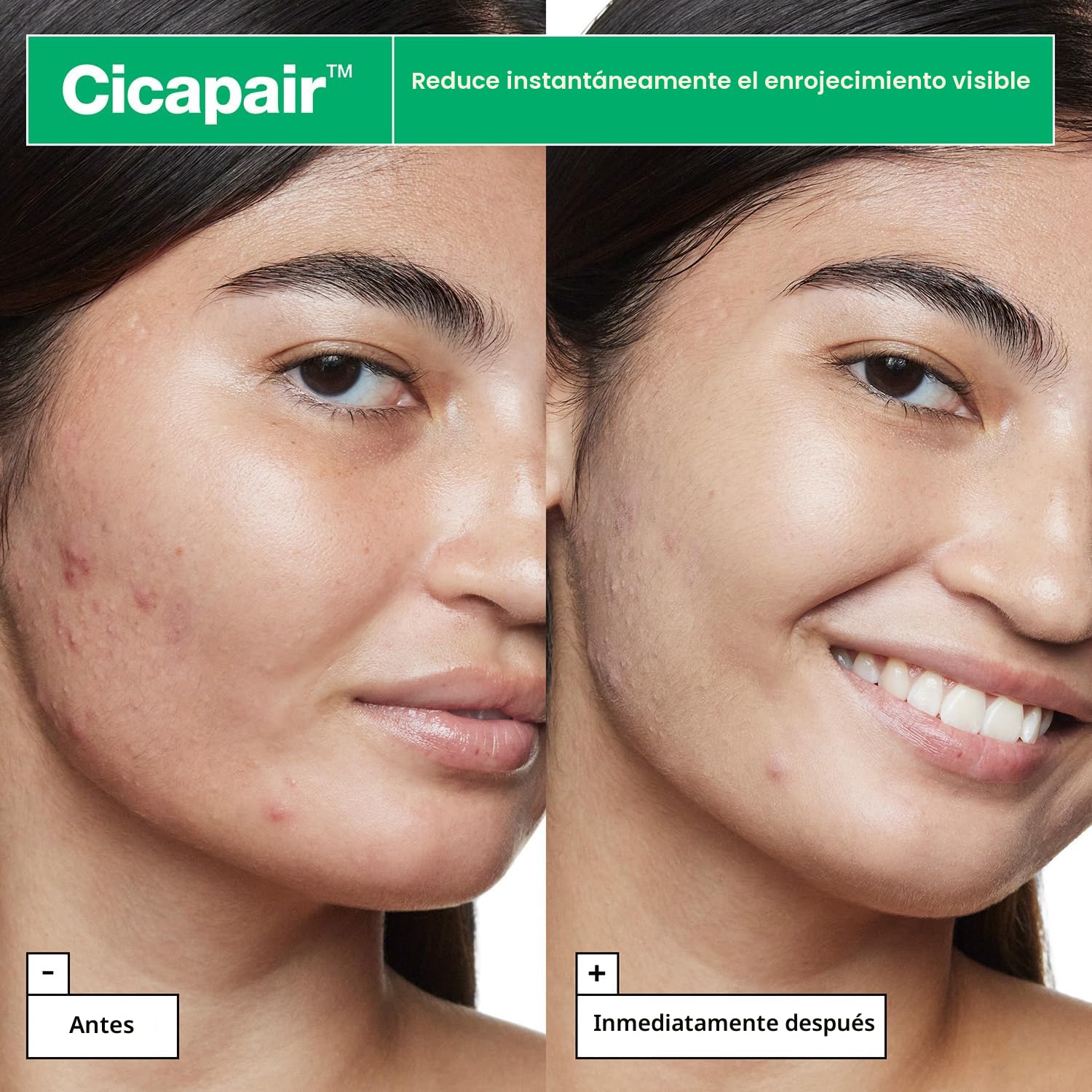 SÉRUM CORRECTOR DE ROJECES DR.JART+ CICAPAIR TIGER GRASS CAMO DROPS 30ML - 3