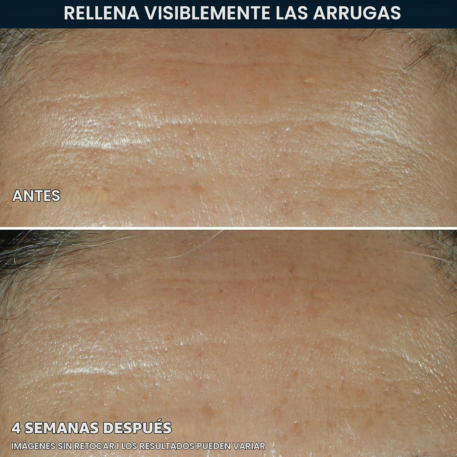 SÉRUM RELLENO DE ARRUGAS ROC RETINOL CORREXION CON ÁCIDO HIALURÓNICO - 4