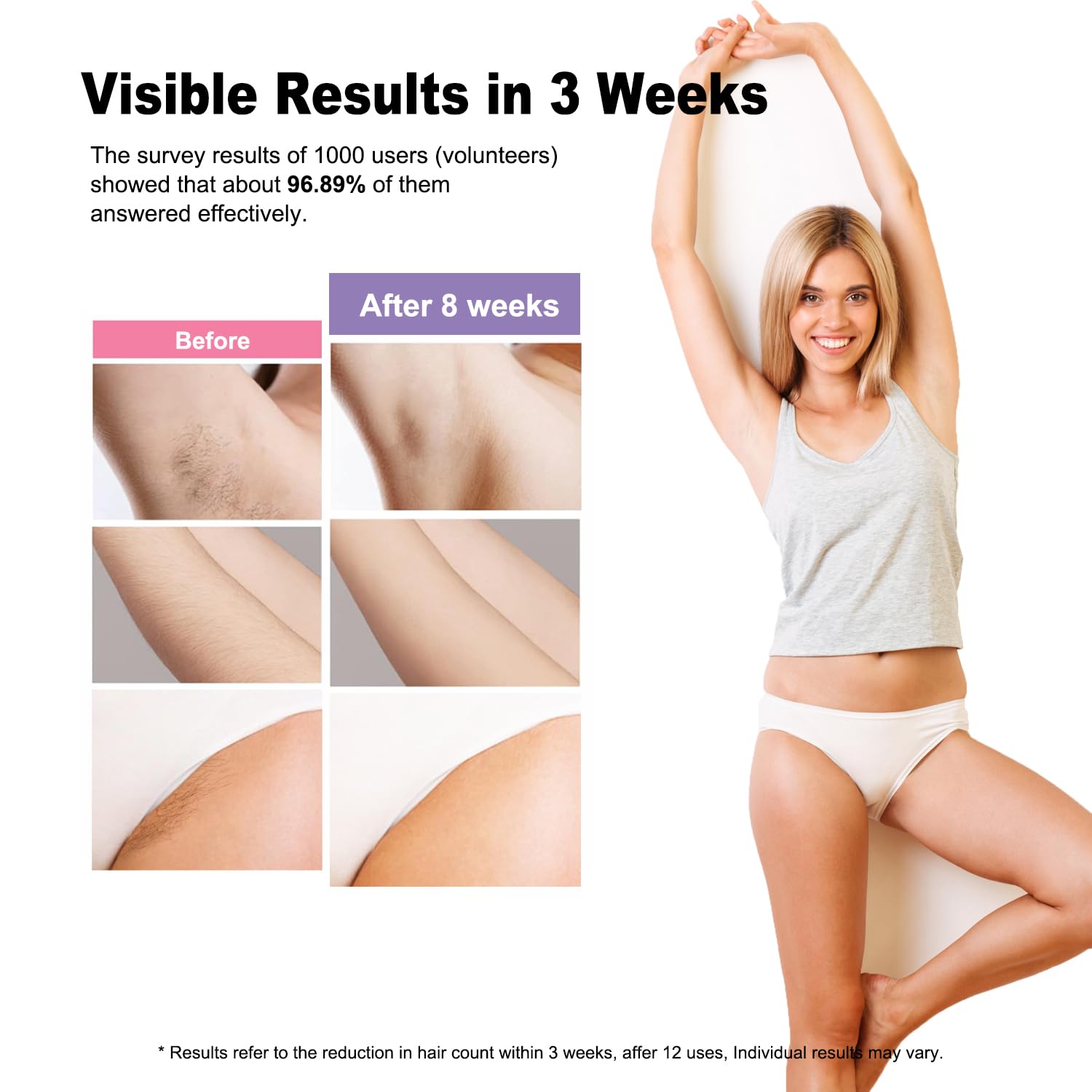 DEPILADOR IPL BETNEP AI08 PARA ROSTRO, PIERNAS, BRAZOS Y LÍNEA DE BIKINI - 5