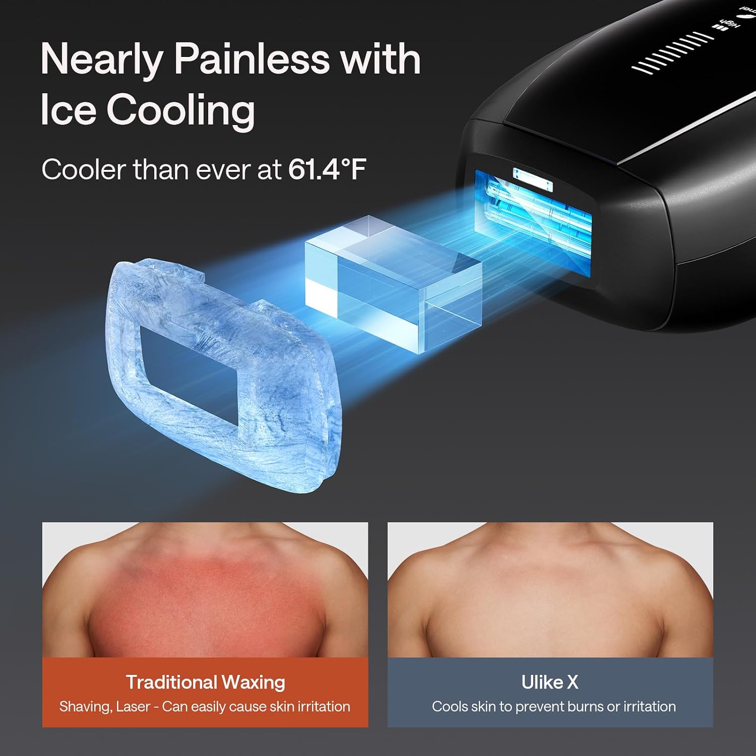 DEPILADOR IPL ULIKE X CON ENFRIAMIENTO POR HIELO Y SENSOR DE PIEL - 3