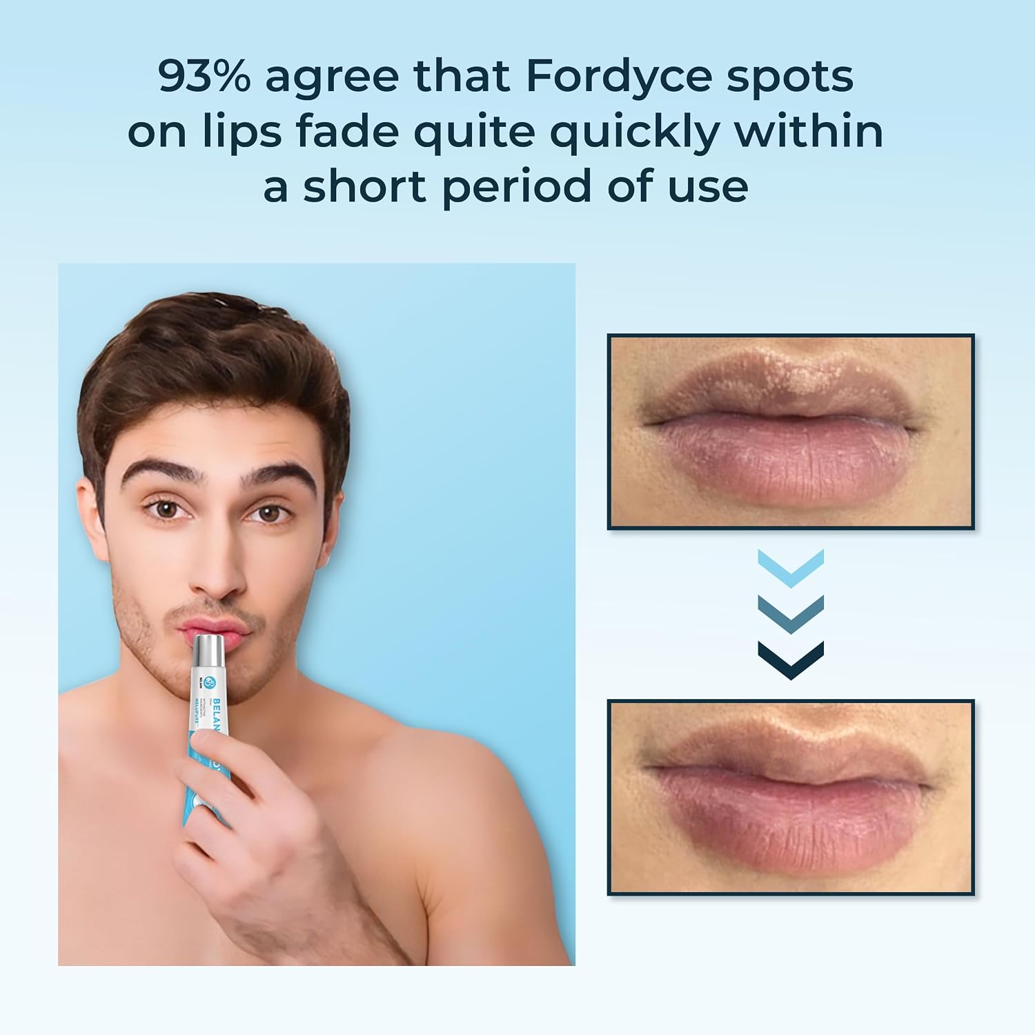 CREMA PARA LABIOS HVSUN BELANI FORDYCE 0.7 OZ - 2