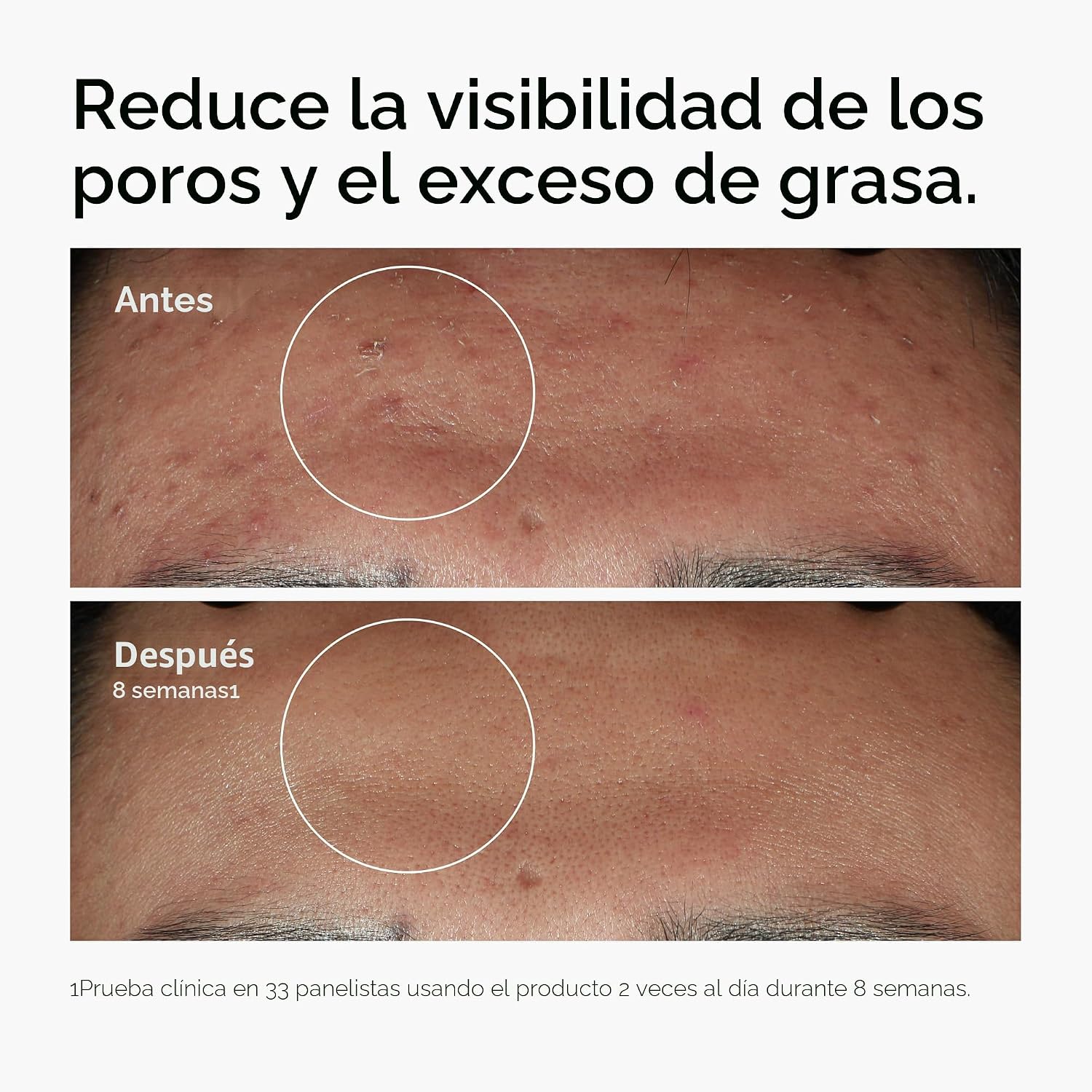SERUM THE ORDINARY NIACINAMIDA 10% + ZINC 1% PARA PIEL PROPENSA AL ACNÉ - 2