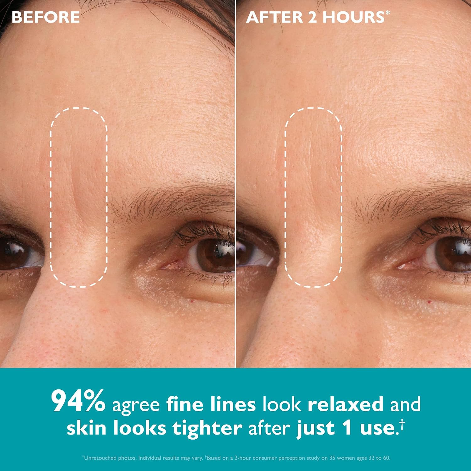 PETER THOMAS ROTH PEPTIDE SKINJECTION CINTA FACIAL INFUSIONADA CON PÉPTIDOS PARA ROSTRO Y CONTORNO DE OJOS - 4