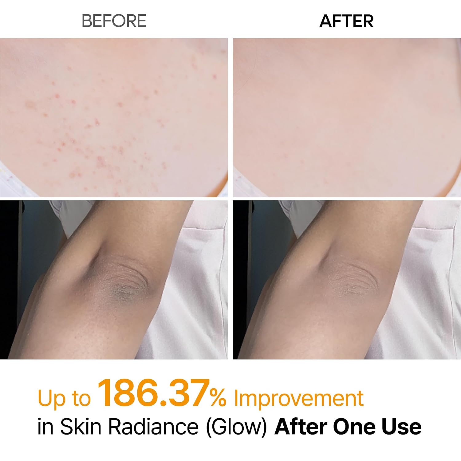 EXFOLIANTE CORPORAL EN SPRAY DR.MELAXIN PEEL SHOT ÁCIDO KÓJICO Y CÚRCUMA 200ML - 3