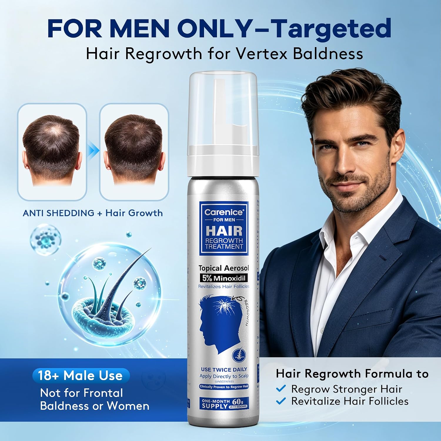 TRATAMIENTO PARA CRECIMIENTO DE CABELLO Y BARBA CARENICE MINOXIDIL 5% ESPUMA SIN AROMA 8.44OZ - 2