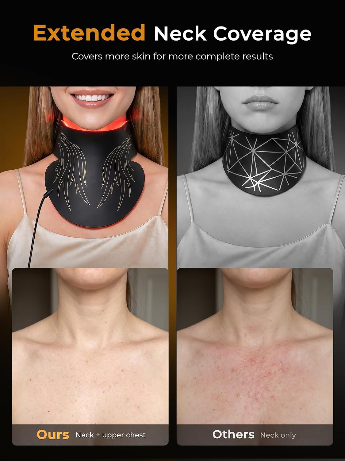 MÁSCARA DE TERAPIA DE LUZ ROJA QYNERA M09 850NM NIR RECARGABLE PARA ROSTRO Y CUELLO NEGRA - 3