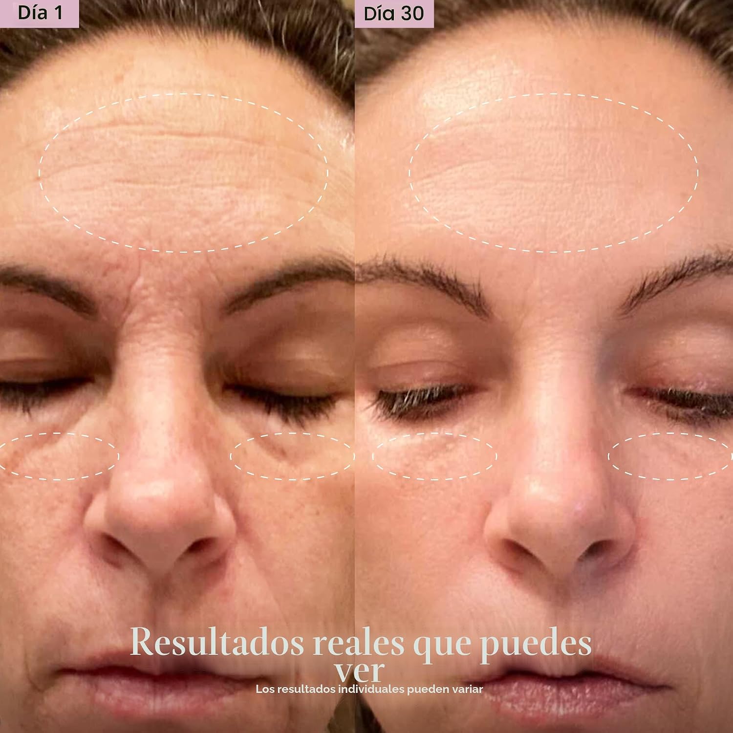 DISPOSITIVO DE TERAPIA DE LUZ ROJA 4 EN 1 SOLAWAVE PARA ROSTRO Y CUELLO CON SUERO ACTIVADOR - 4