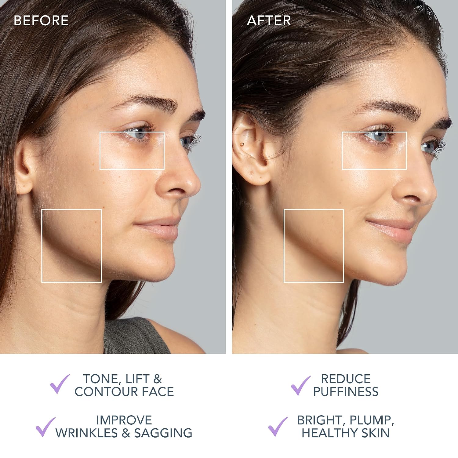 DISPOSITIVO FACIAL FOREO BEAR 2 ADVANCED MICROCURRENT PARA LIFTING Y TONIFICACIÓN - 5