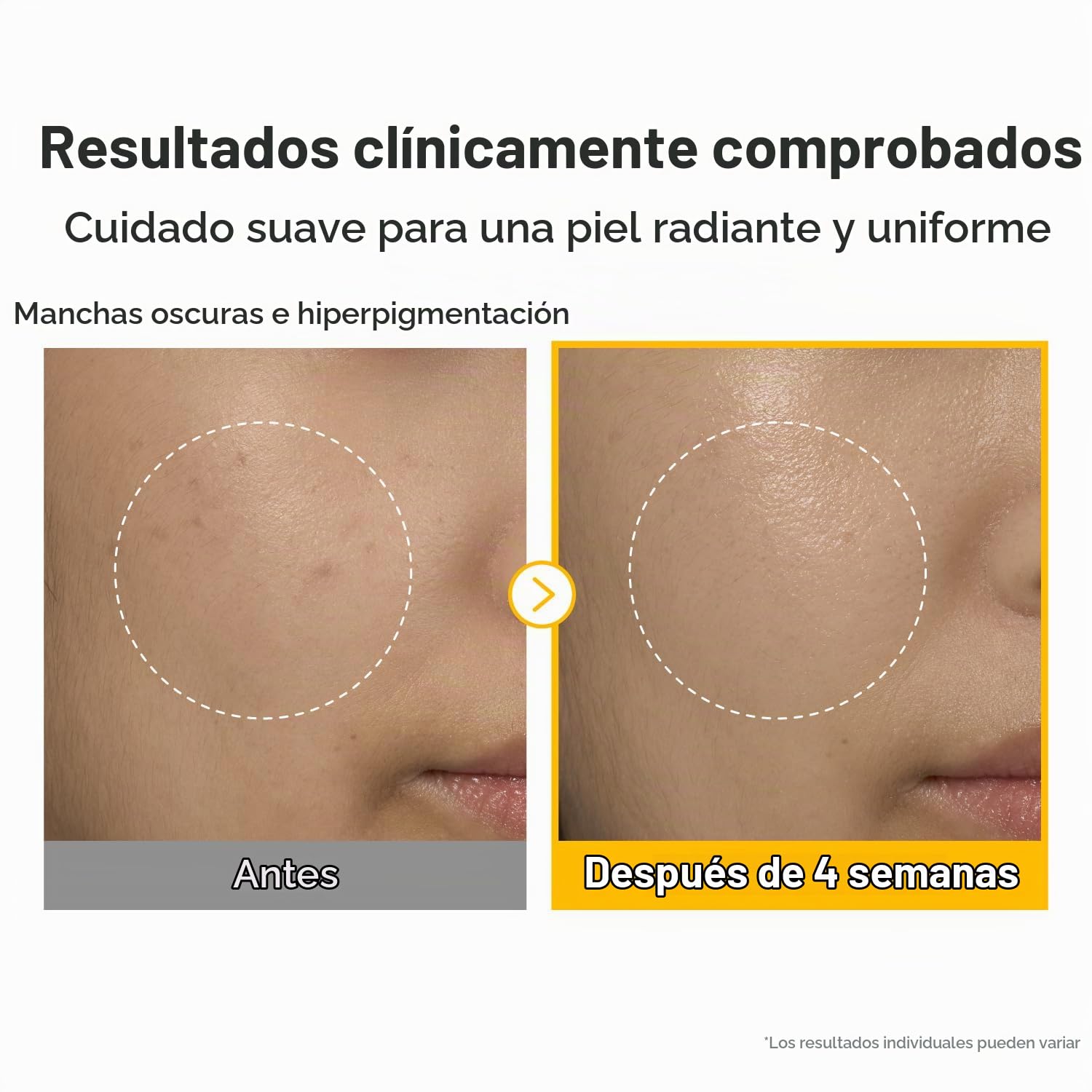SUERO CONCENTRADO VITAMINAS NUMBUZIN NO.5 PARA MANCHAS OSCURAS 30 ML - 4