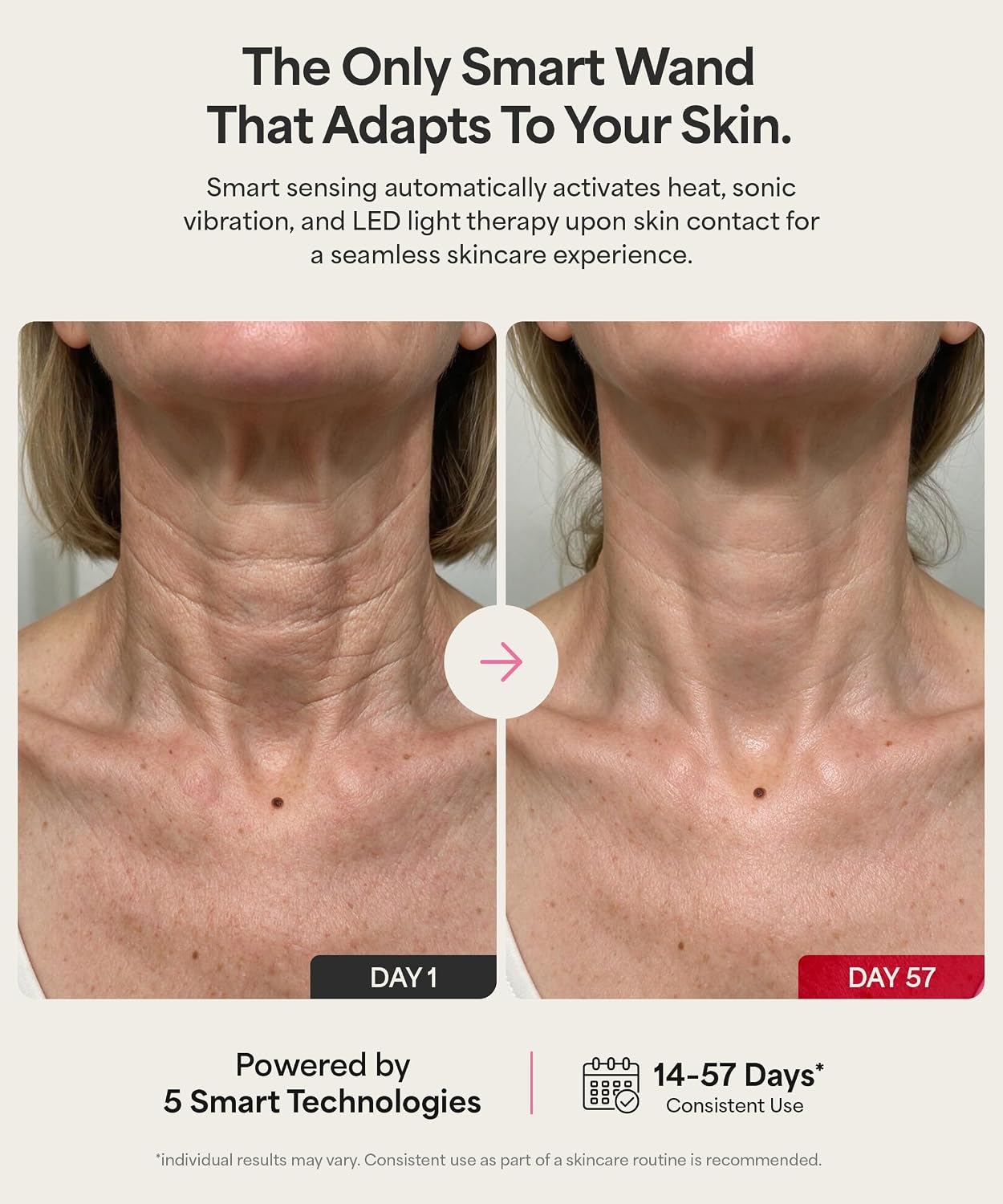 MASAJEADOR FACIAL REVOMADIC REVO GENIE CON LUZ LED Y CALOR - 4