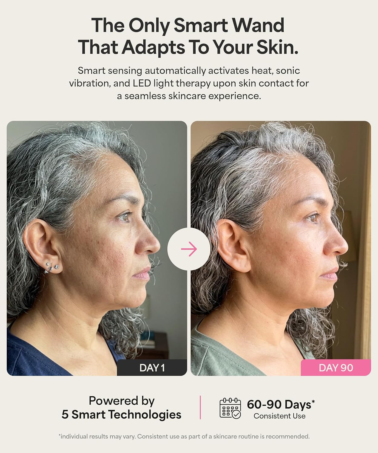 MASAJEADOR FACIAL REVOMADIC REVO GENIE CON LUZ LED Y CALOR - 5