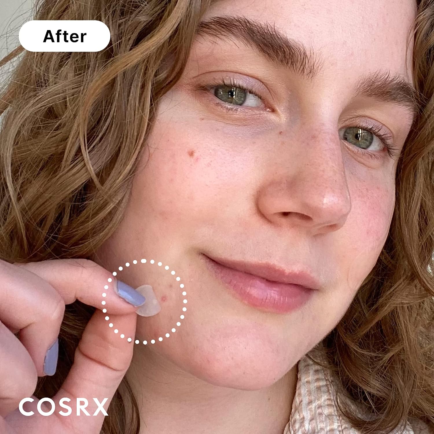PARCHE PARA ACNÉ COSRX ACNE PIMPLE PATCHES HIDROCOLOIDE 48 UNIDADES 3 TAMAÑOS - 2