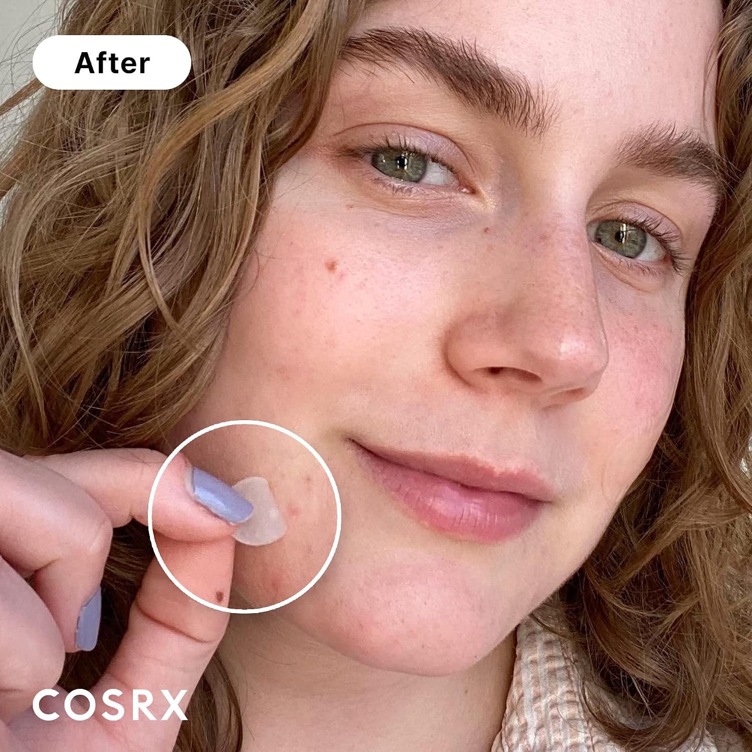 MASCARILLA FACIAL COSRX ACNE PIMPLE PATCHES HIDROCOLOIDE 120 UNIDADES 3 TAMAÑOS - 3