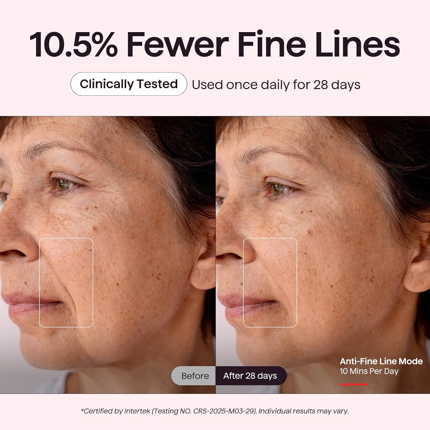 MÁSCARA DE TERAPIA DE LUZ ROJA WAVYTALK PARA ROSTRO ROSA - 4
