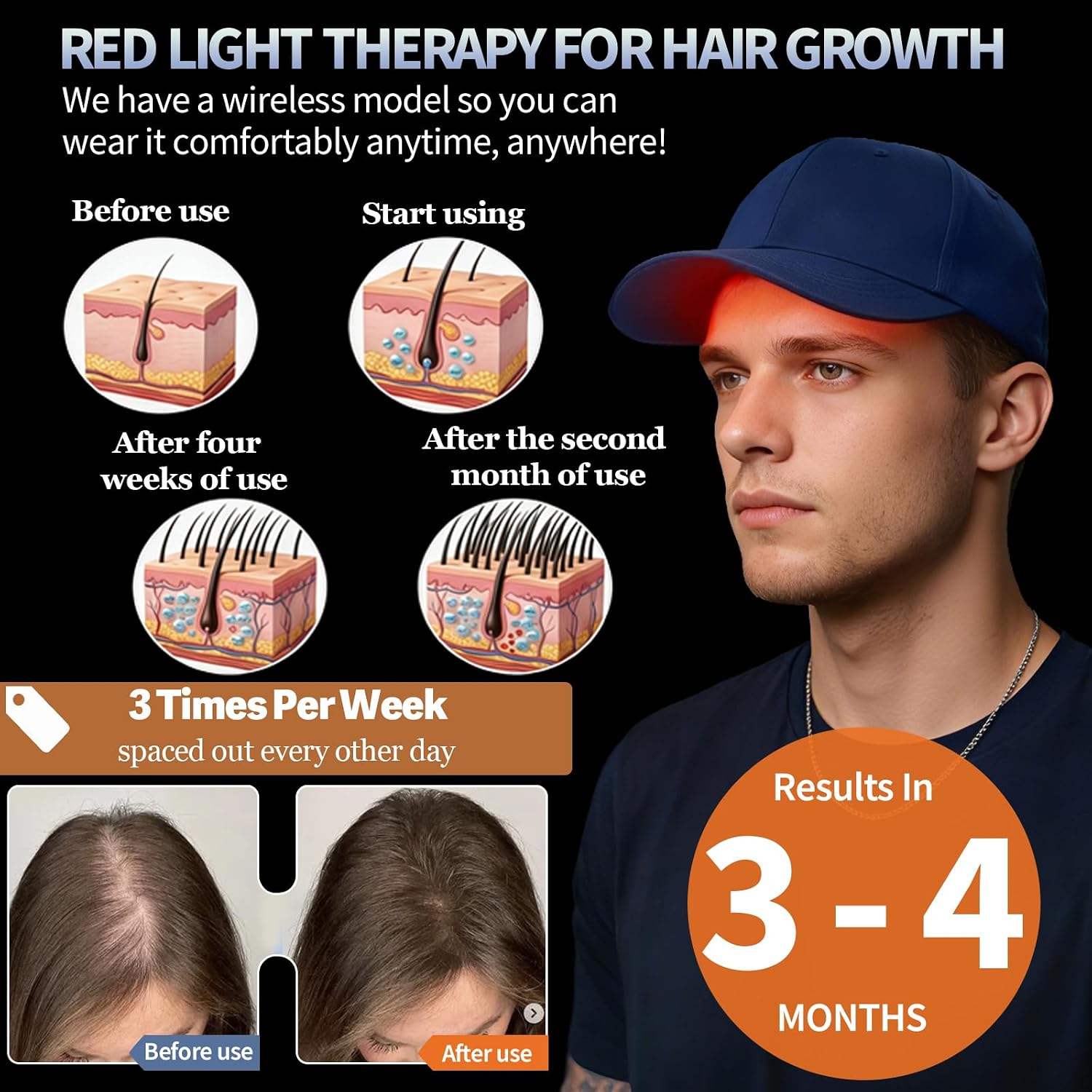 ALMOHADILLA TERAPÉUTICA YARO TRADING RED LIGHT THERAPY PARA CRECIMIENTO CAPILAR MANOS LIBRES - 3