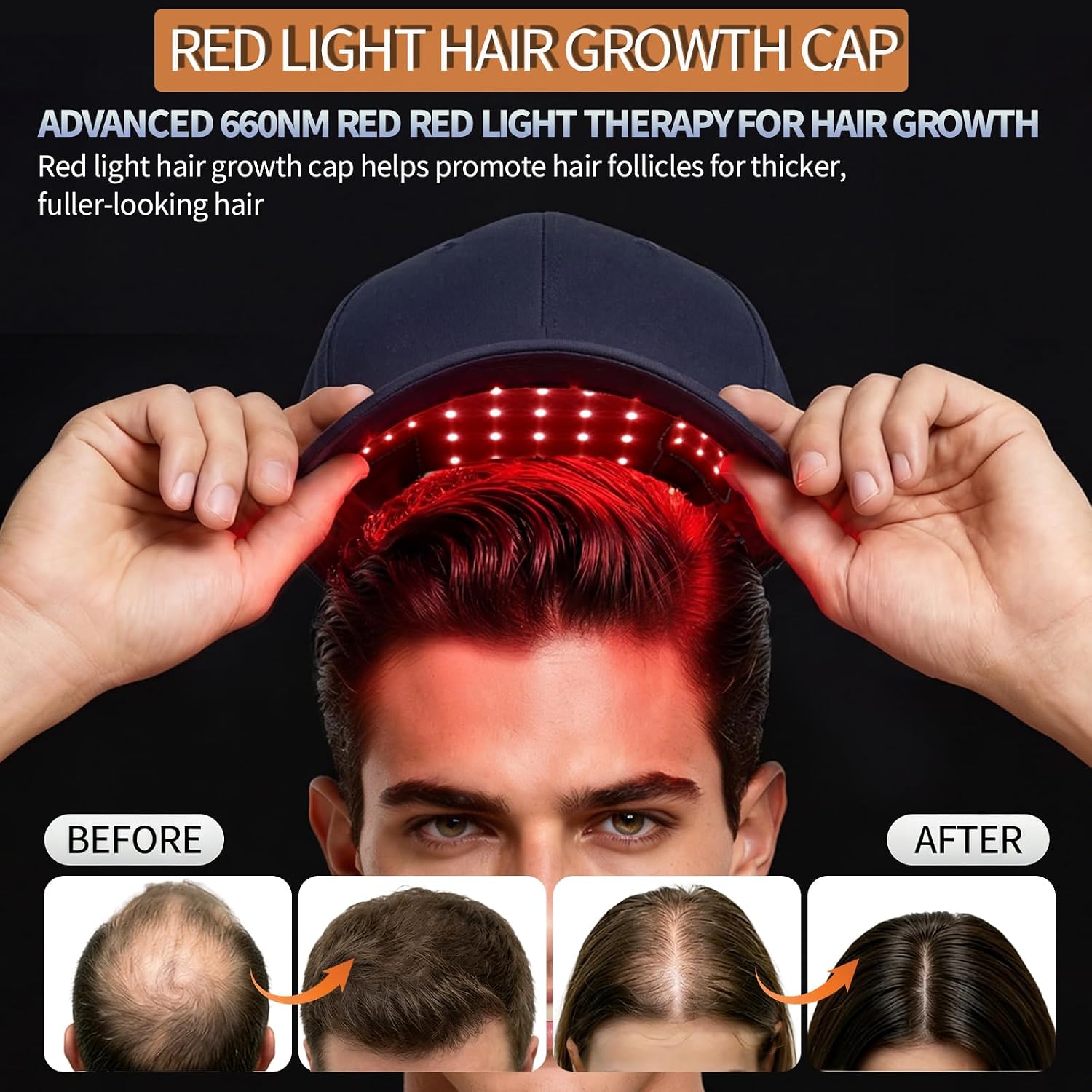 ALMOHADILLA TERAPÉUTICA YARO TRADING RED LIGHT THERAPY PARA CRECIMIENTO CAPILAR MANOS LIBRES - 4