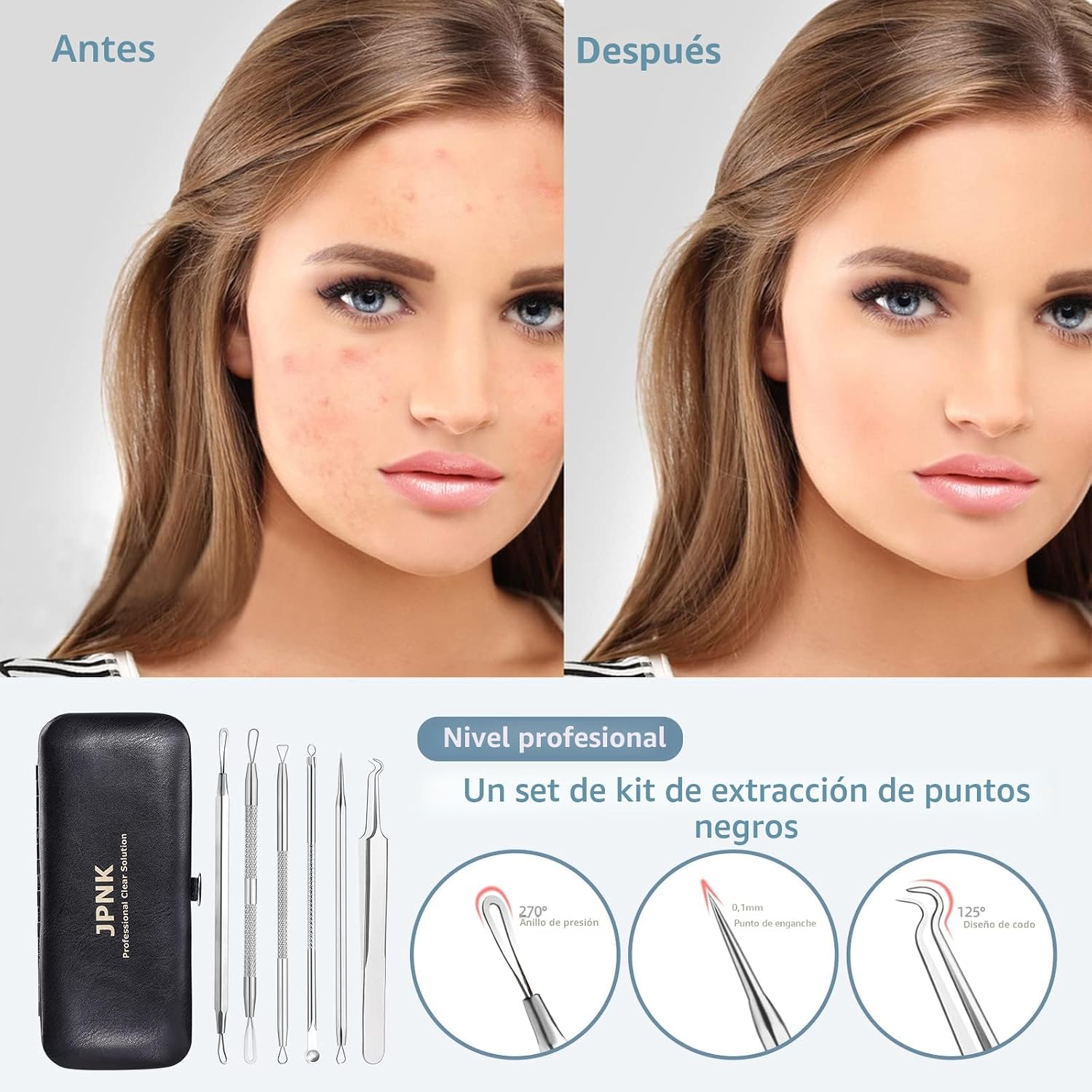 KIT REMOVEDOR DE PUNTOS NEGROS JPNK ACERO INOXIDABLE 304 - 2