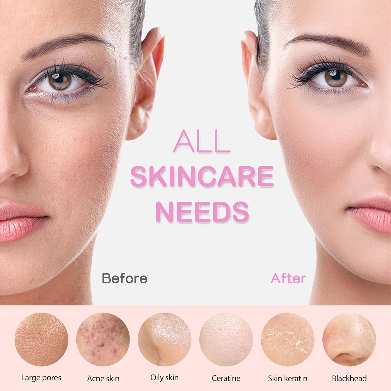 CEPILLO FACIAL PRITECH RECARGABLE CON MASAJE TÉRMICO Y VIBRACIÓN ROSA - 5