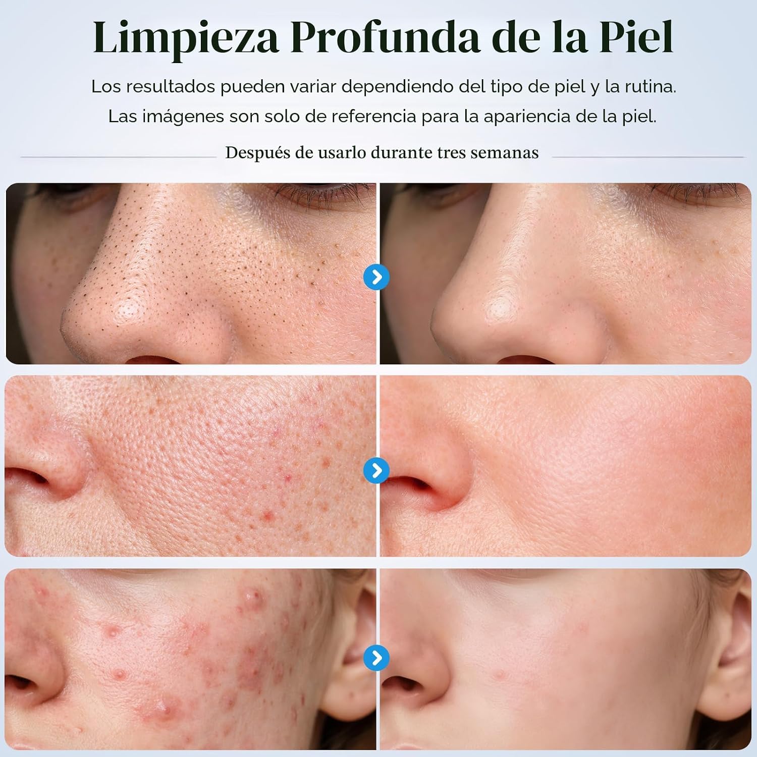 ESPÁTULA LIMPIADORA DE POROS GUGUG SKIN SCRUBBER 4 MODOS BLANCO - 4