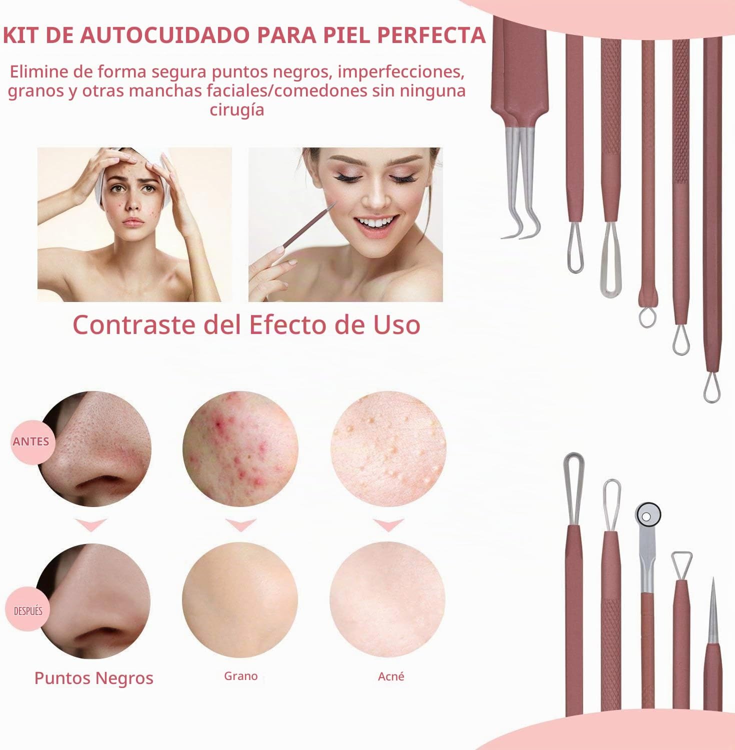 KIT REMOVEDOR DE PUNTOS NEGROS JPNK 6 PIEZAS CON ESTUCHE DE CUERO ROSA - 2
