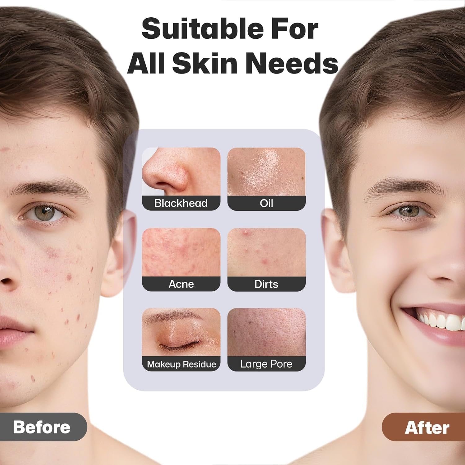 CEPILLO FACIAL PRITECH RECARGABLE CON MASAJE TÉRMICO Y SILICONA NEGRO - 5