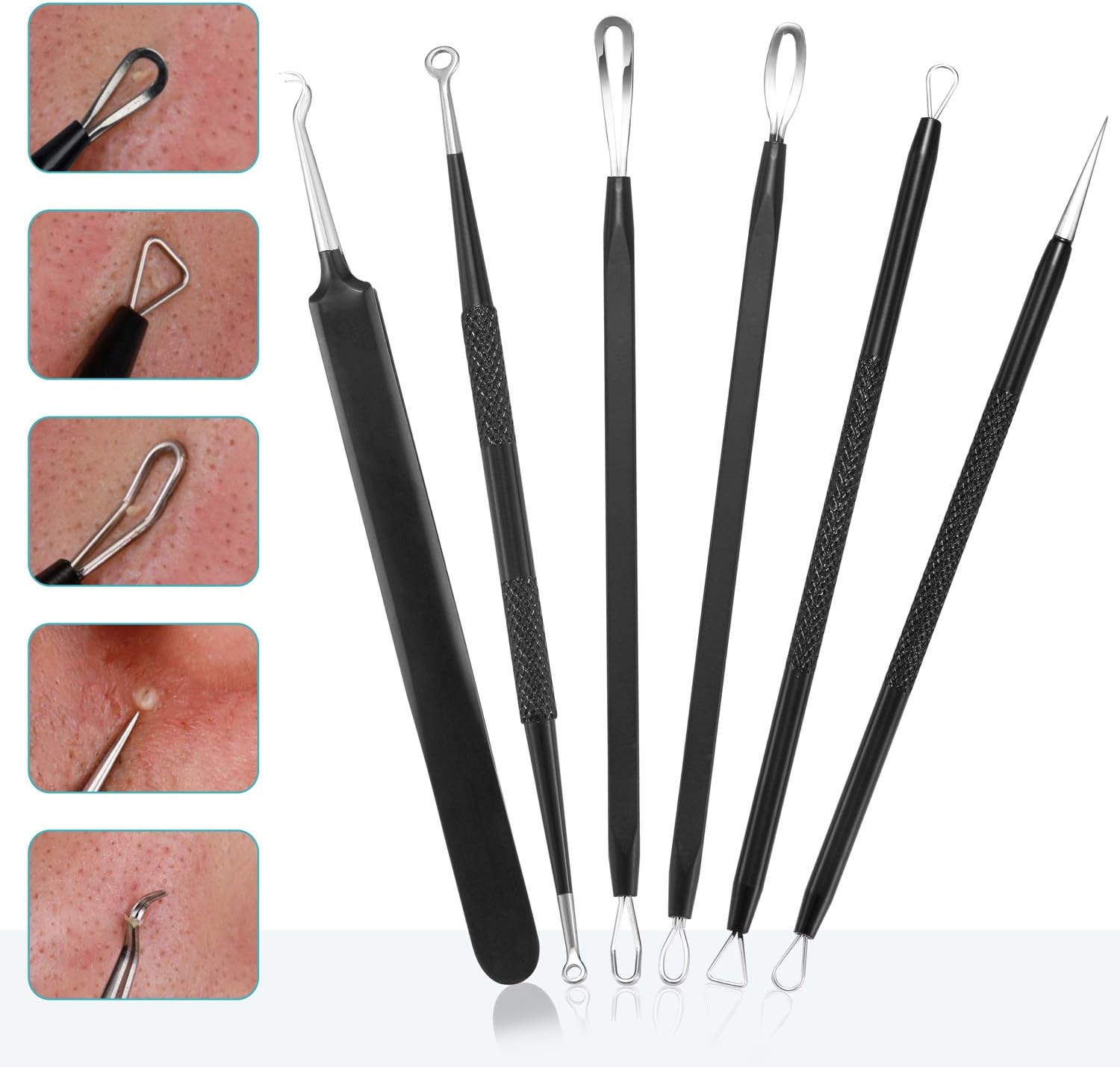 KIT REMOVEDOR DE PUNTOS NEGROS TOMATA 6 PIEZAS ACERO INOXIDABLE - 2