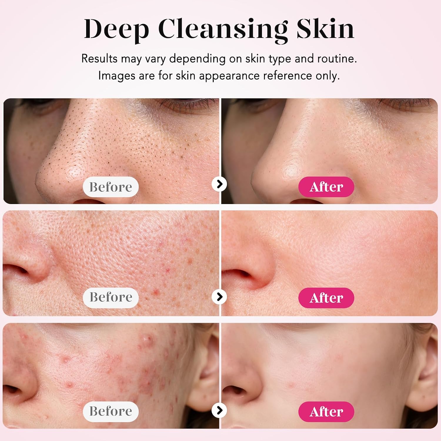 ESPÁTULA LIMPIADORA FACIAL GUGUG SKIN SCRUBBER 4 MODOS ROSA - 4