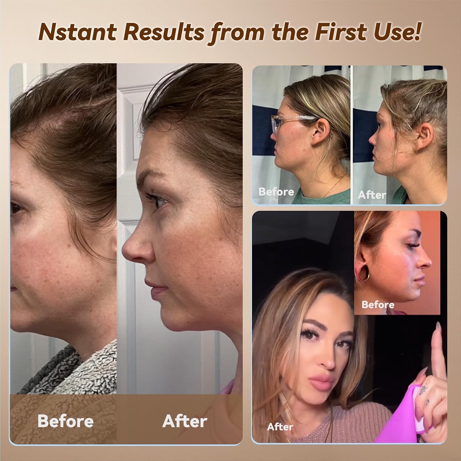MASCARILLA DE LEVANTAMIENTO FACIAL JUSRON V-LINE COLOR CELESTE CLARO - 3